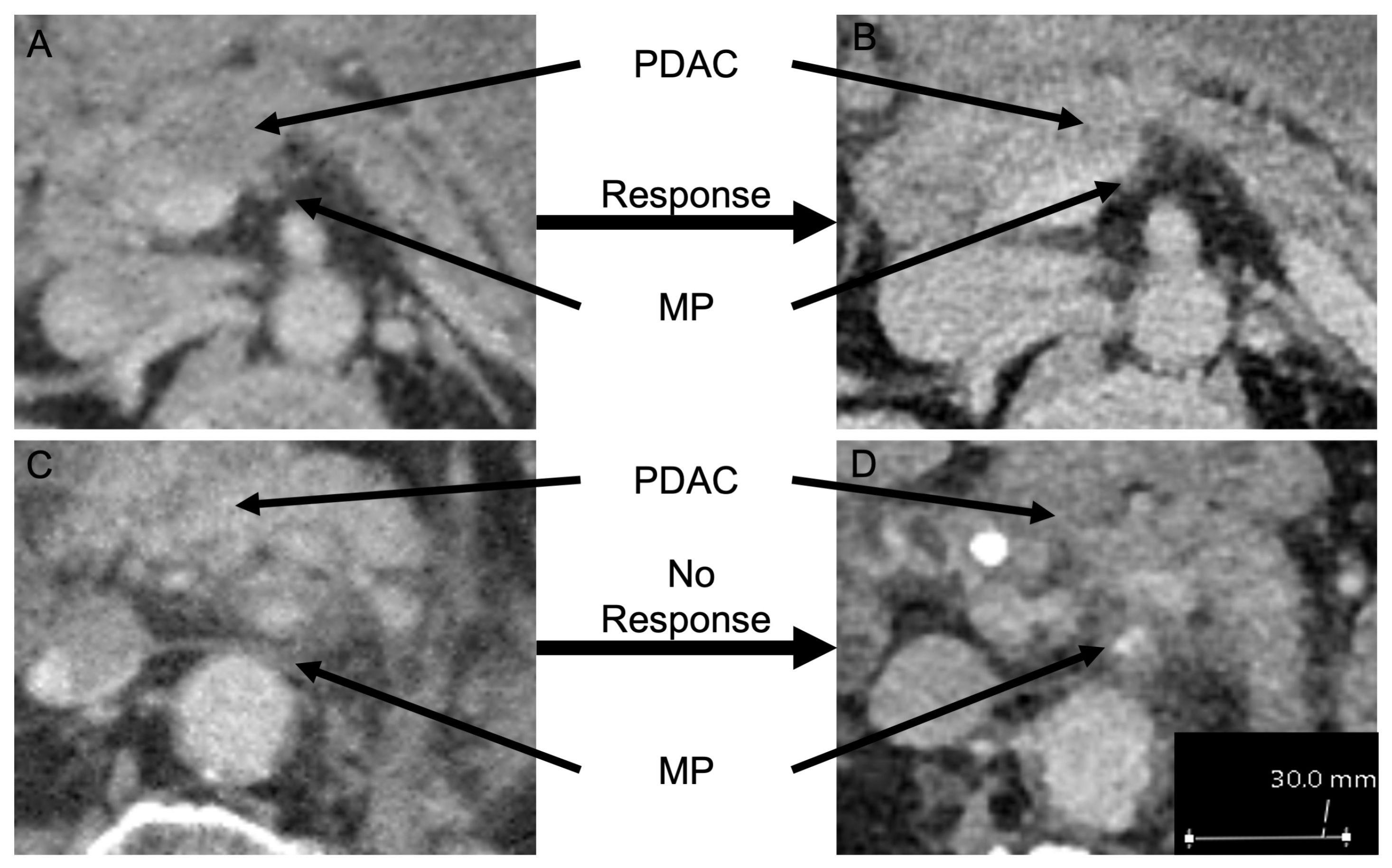 Cancers 14 00068 g001