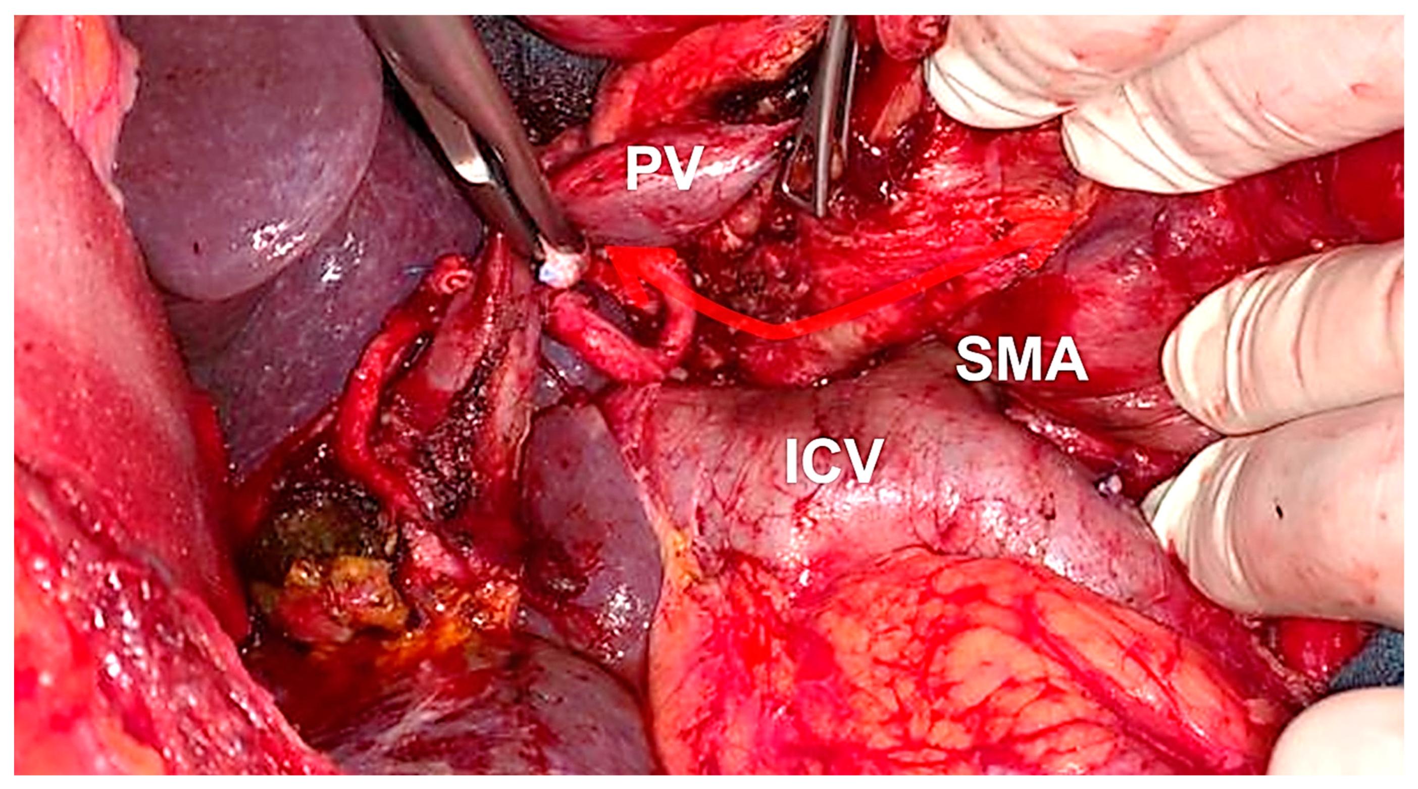 Cancers 14 00068 g002