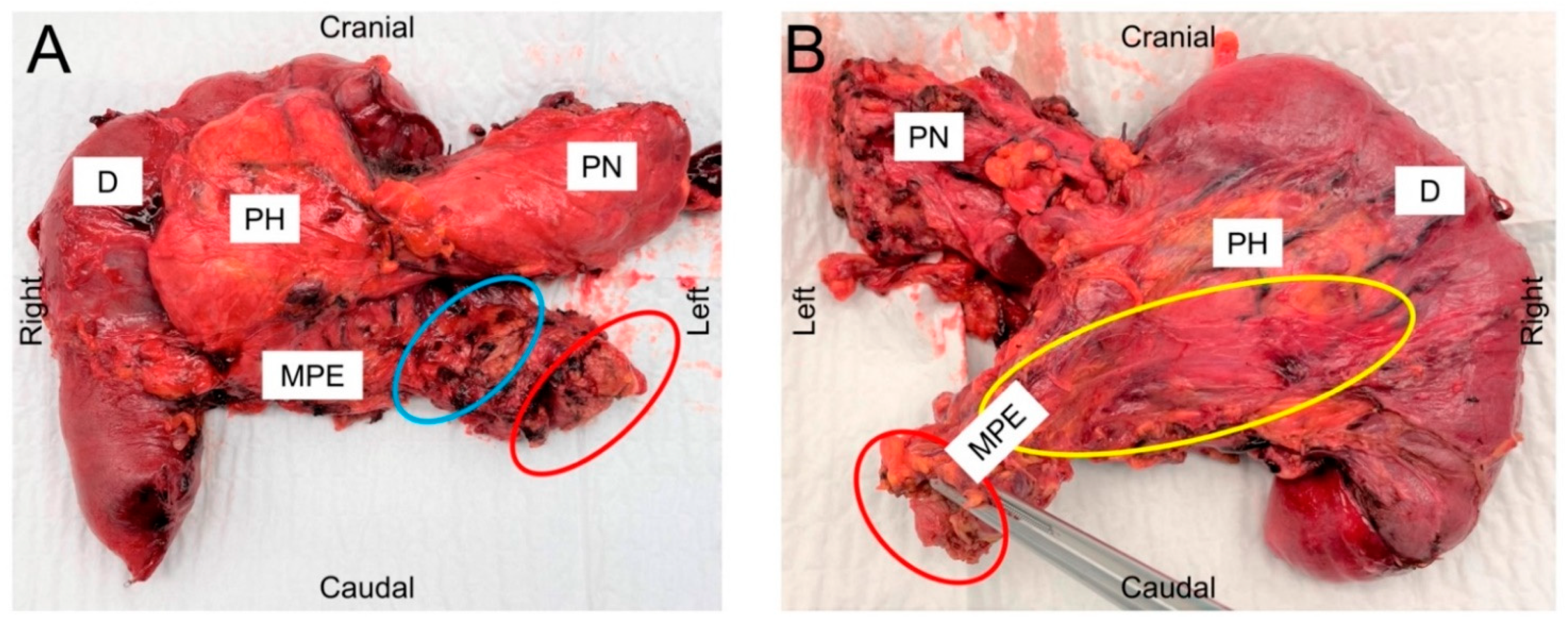 Cancers 14 00068 g003