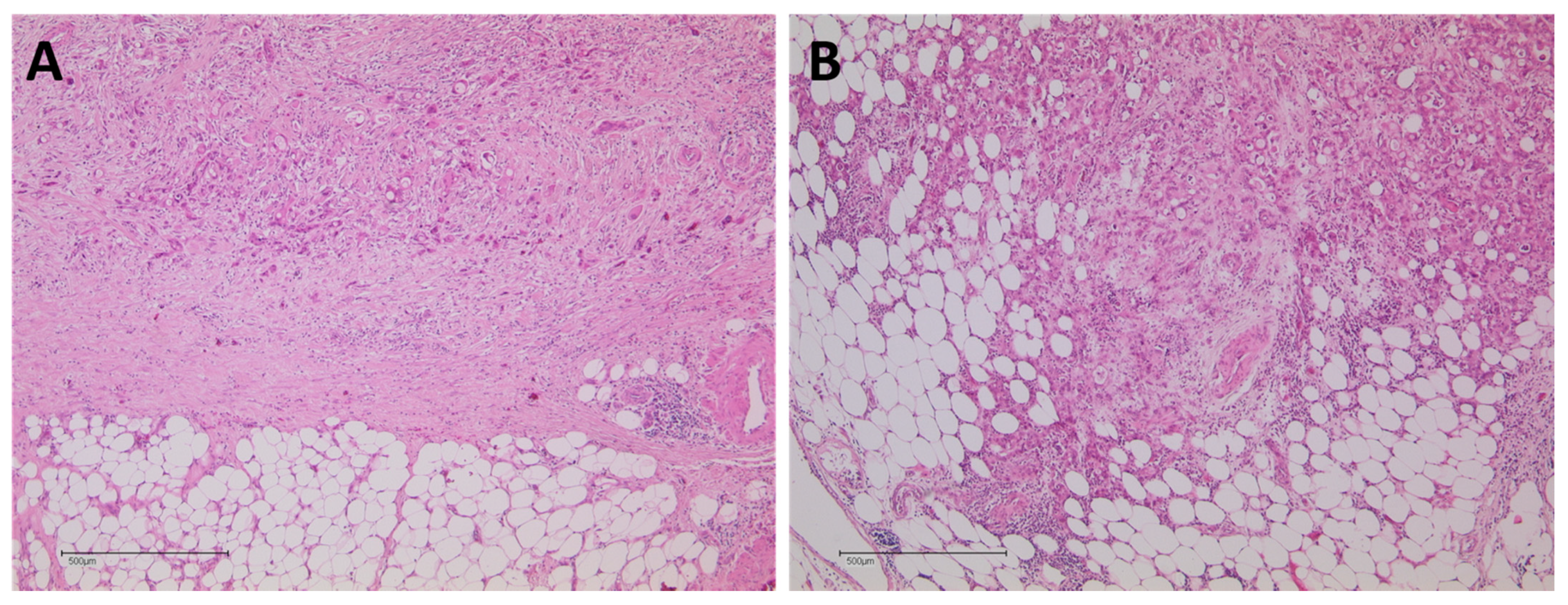 Cancers 14 00068 g004