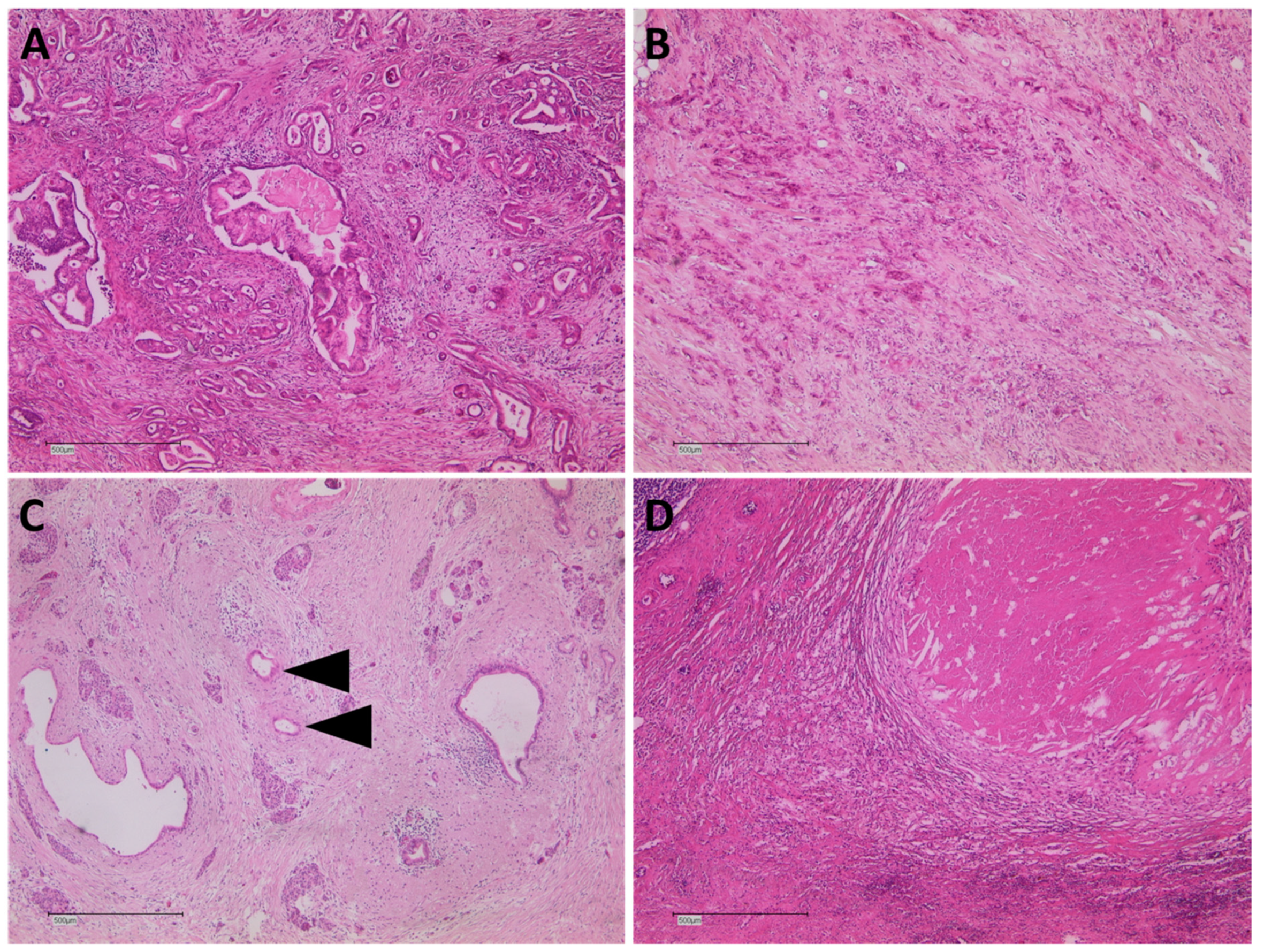Cancers 14 00068 g005