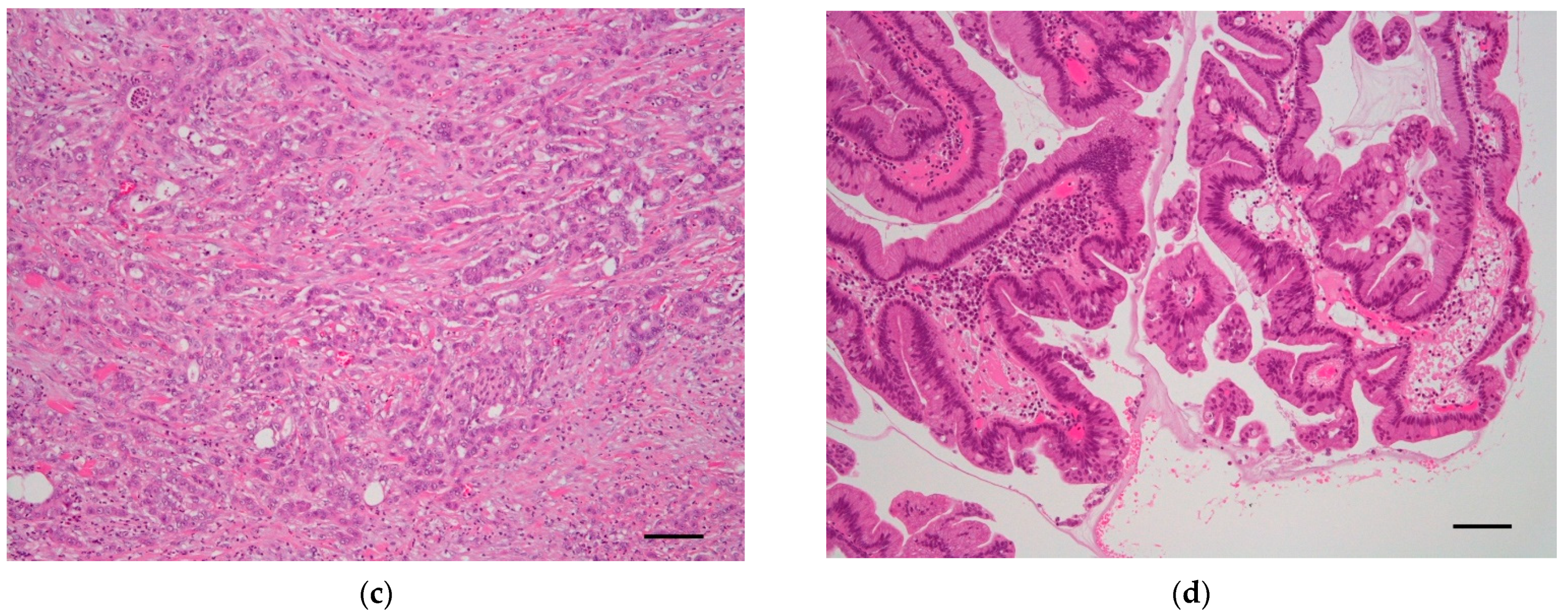 Cancers 14 00071 g003b