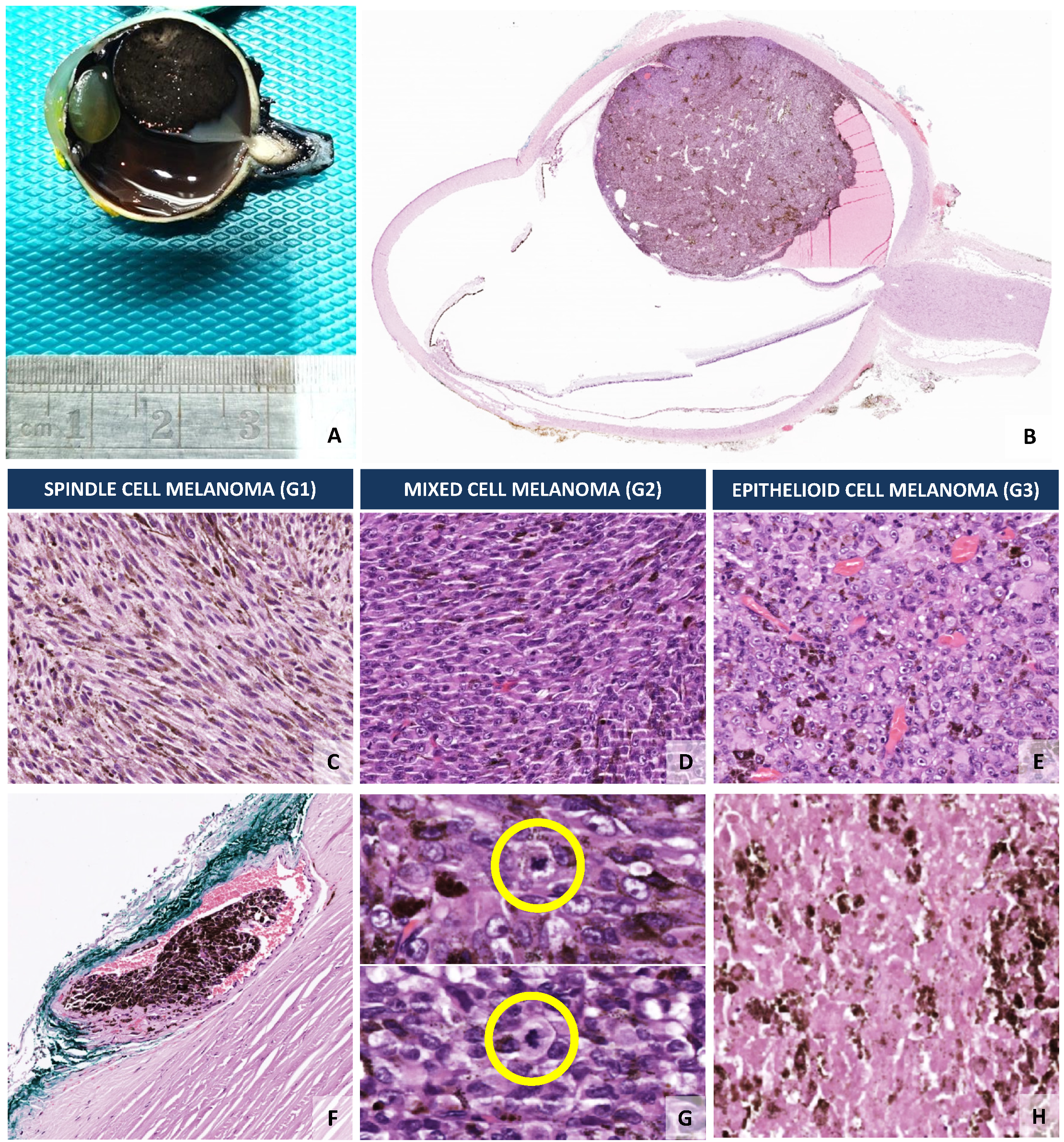 Cancers 14 00096 g002 Cancers 14 00096 g002