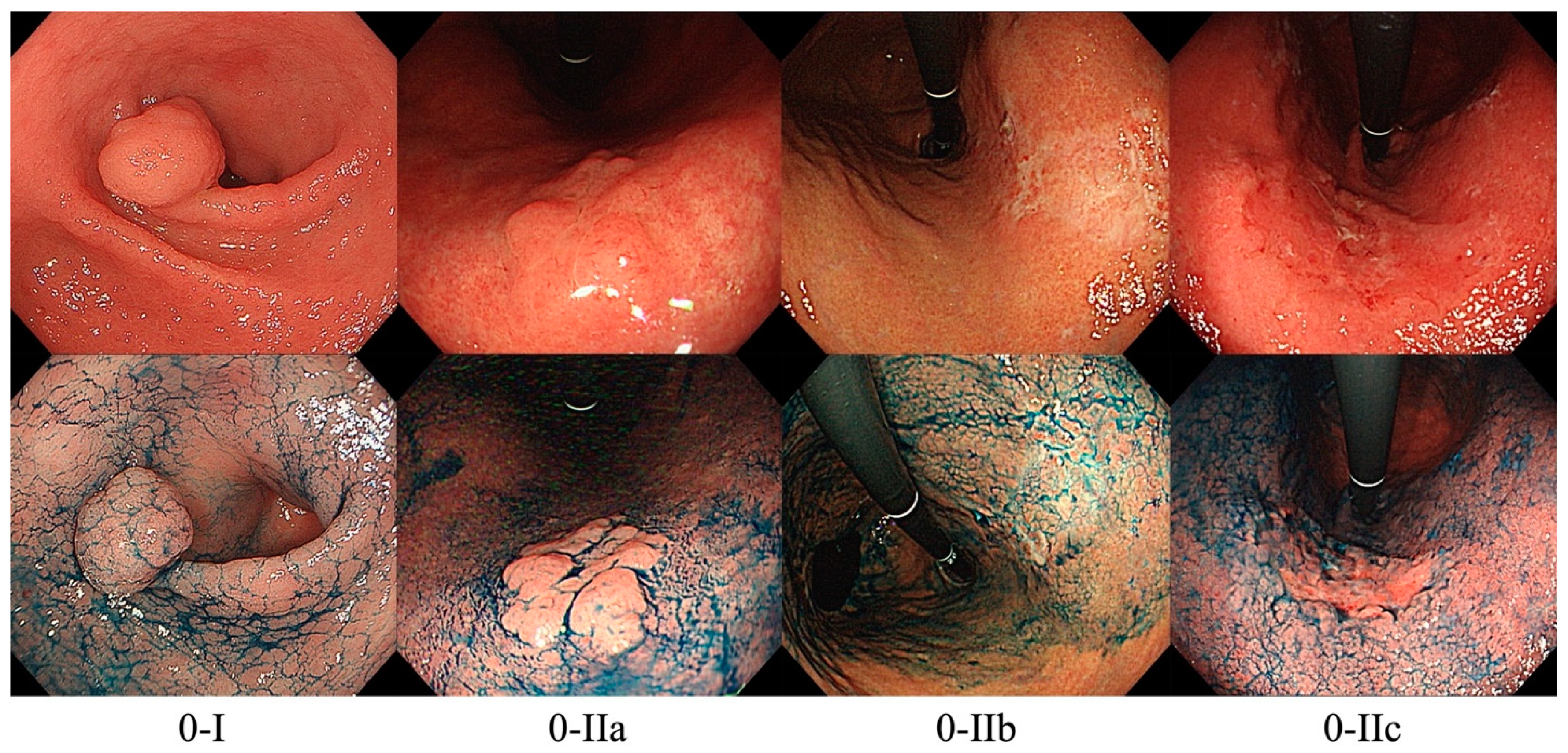 Cancers 14 00100 g001 550