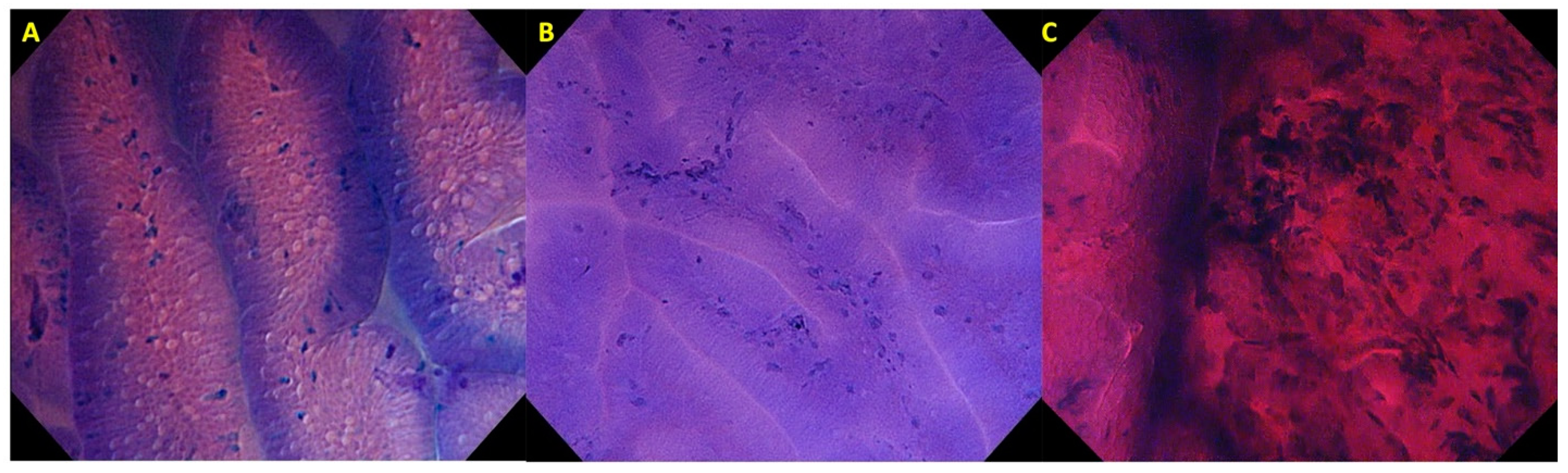 Cancers 14 00100 g004 550