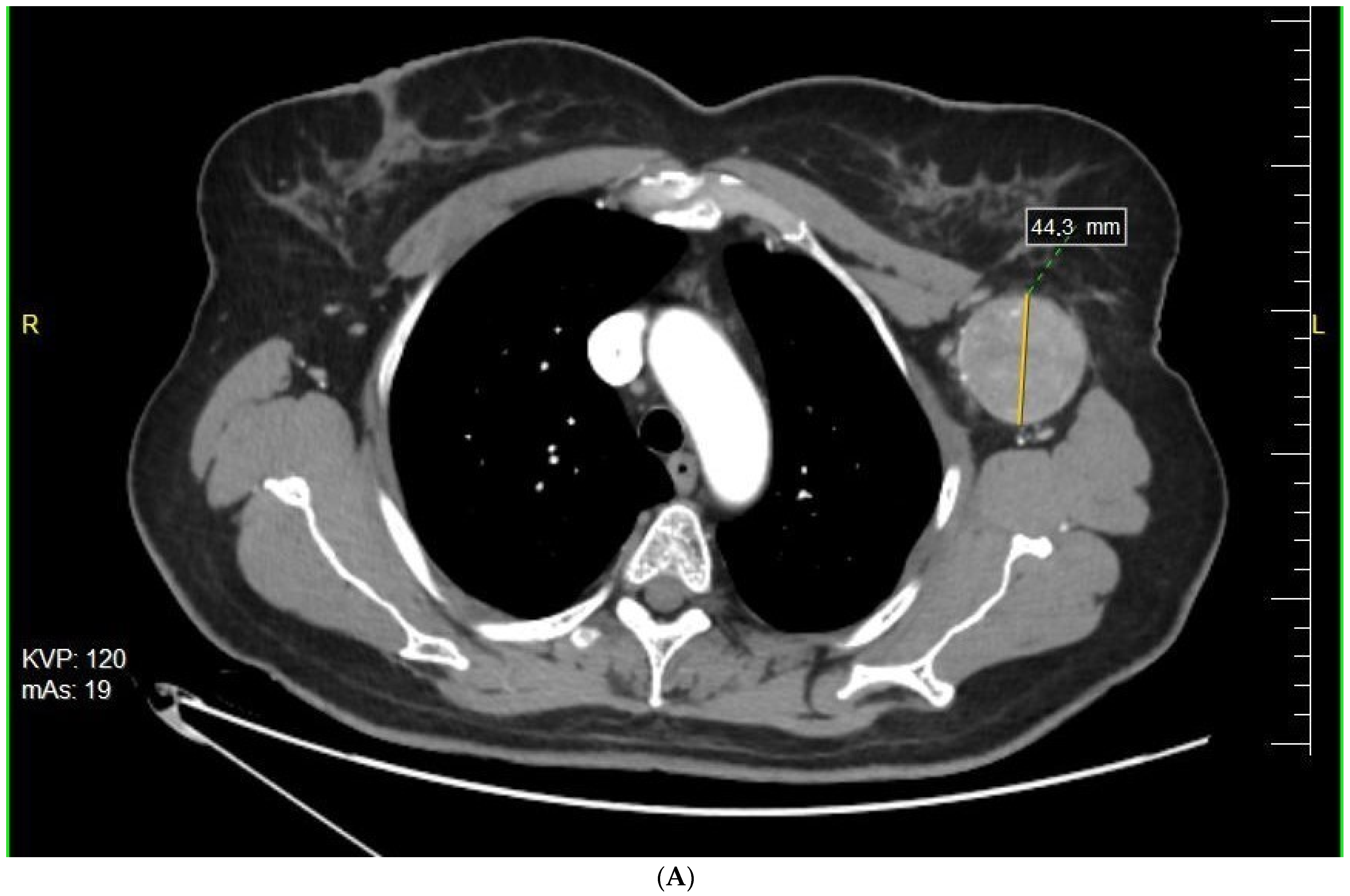 Cancers 14 00110 g001a