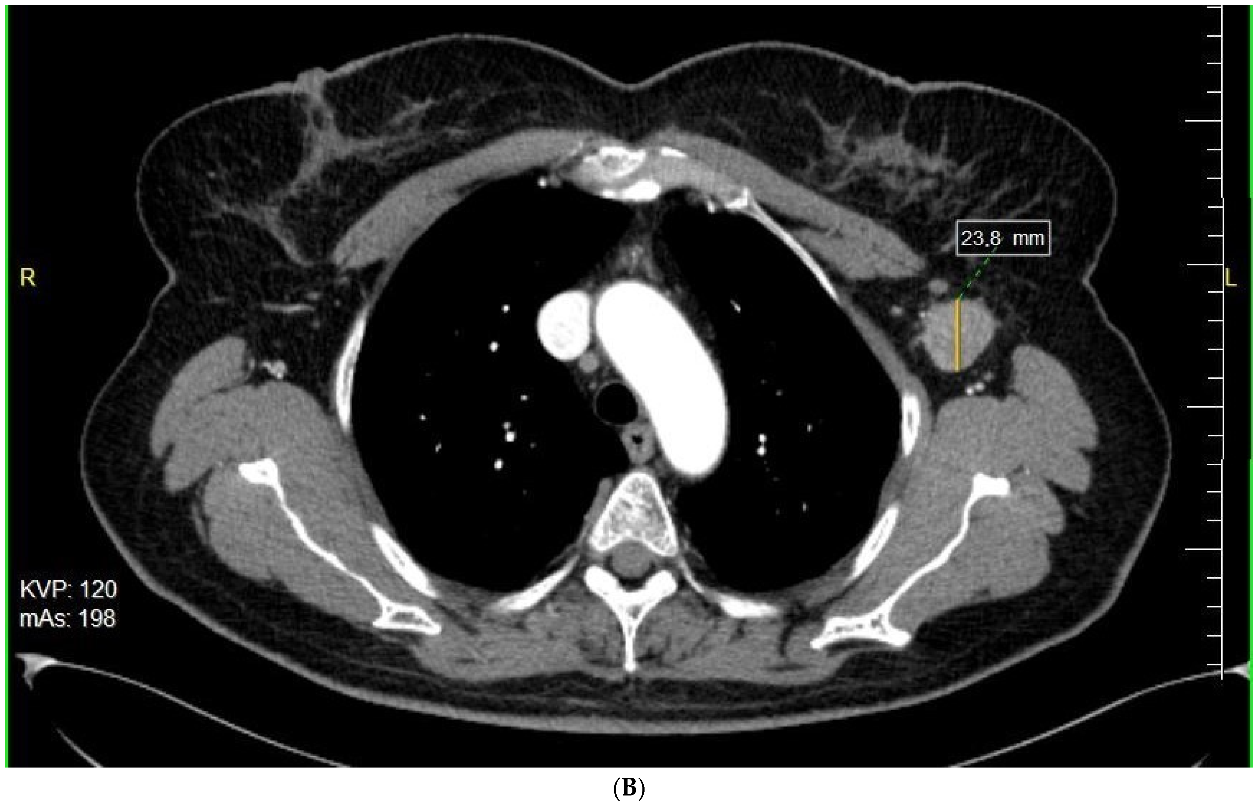 Cancers 14 00110 g001b