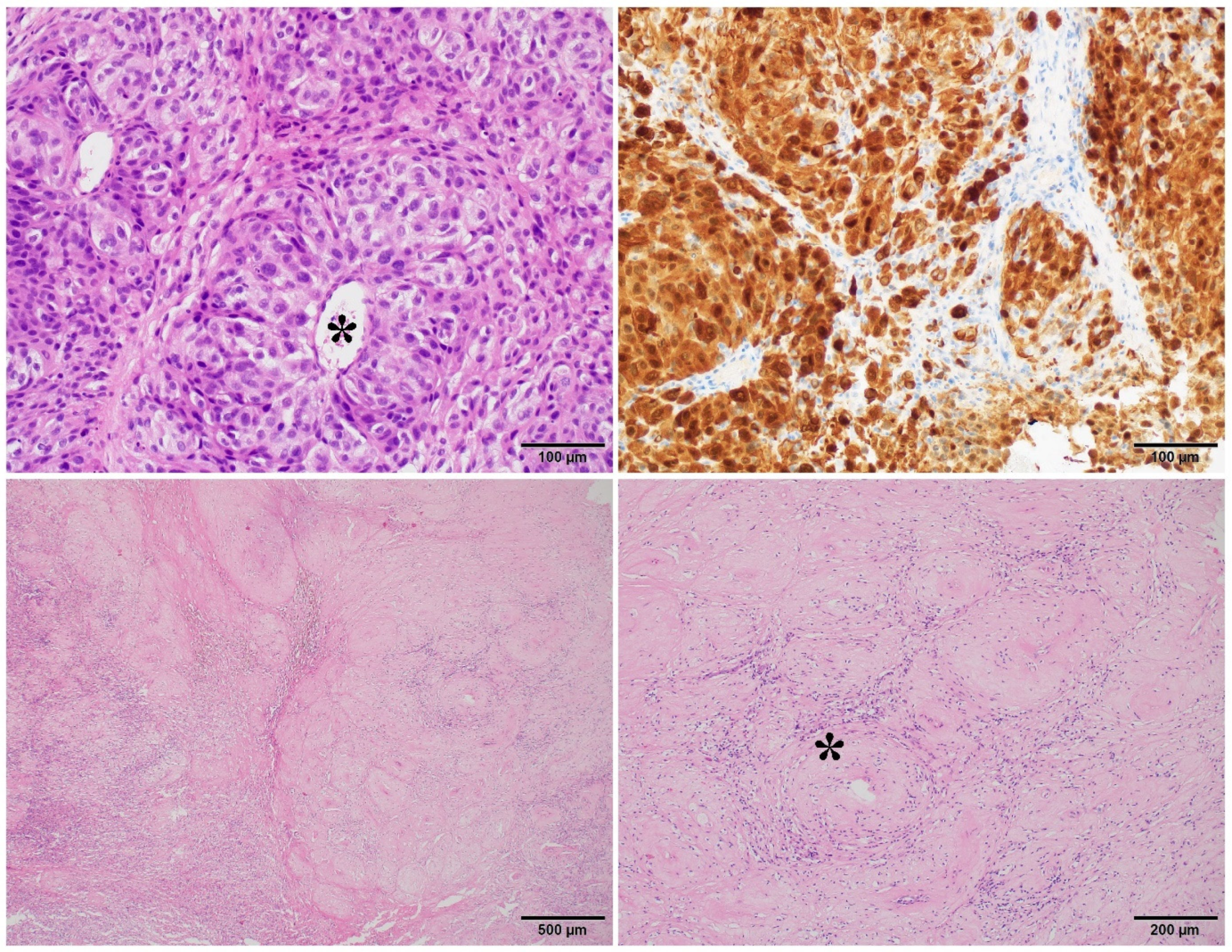 Cancers 14 00110 g002