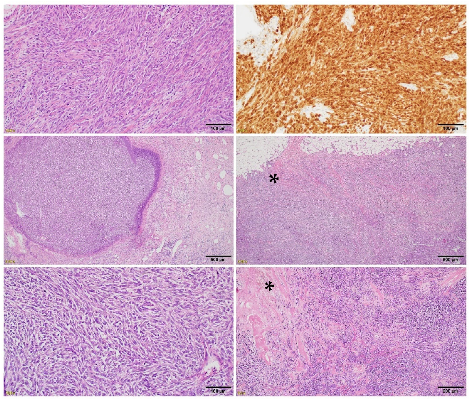 Cancers 14 00110 g004