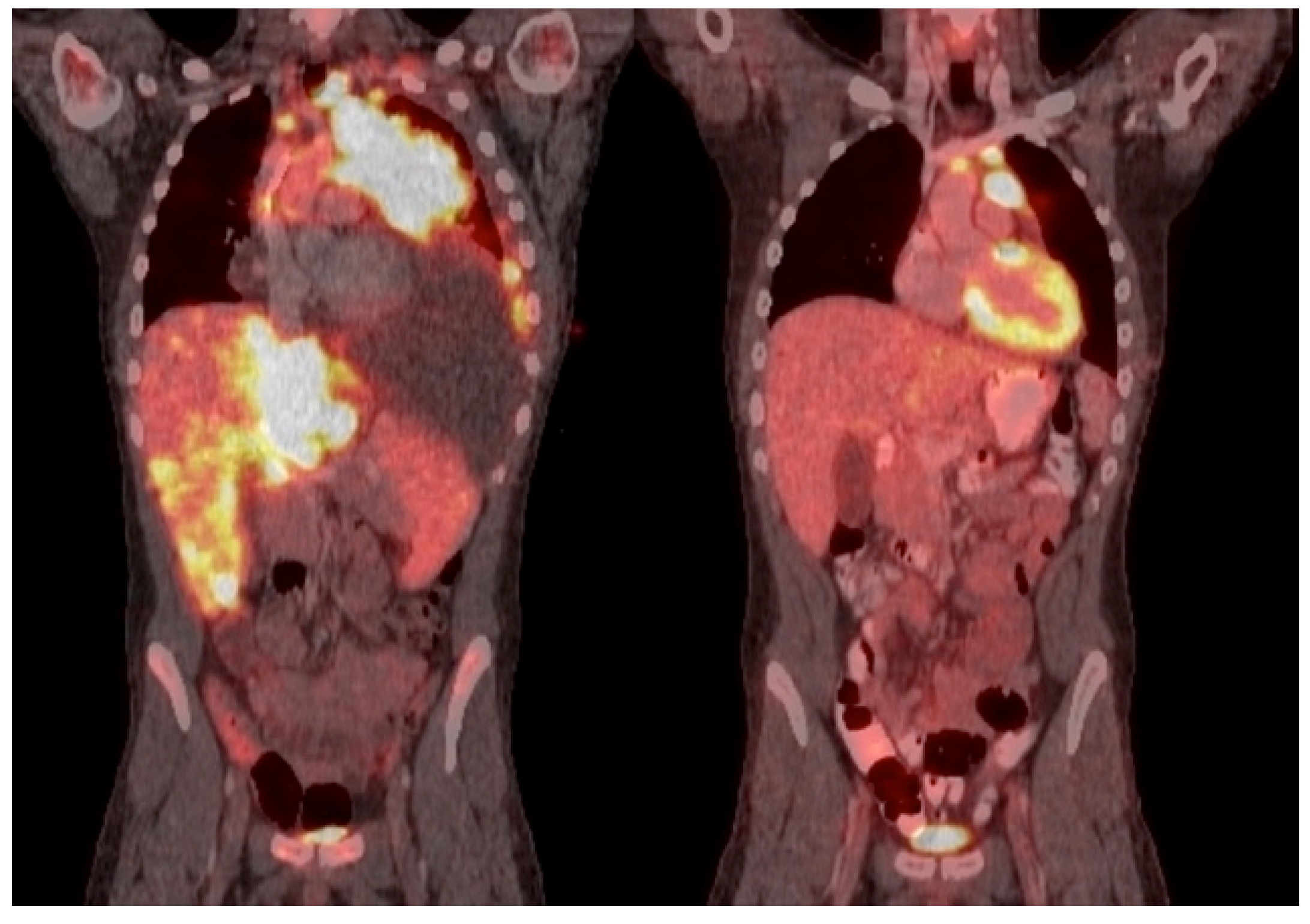 Cancers 14 00150 g002 550