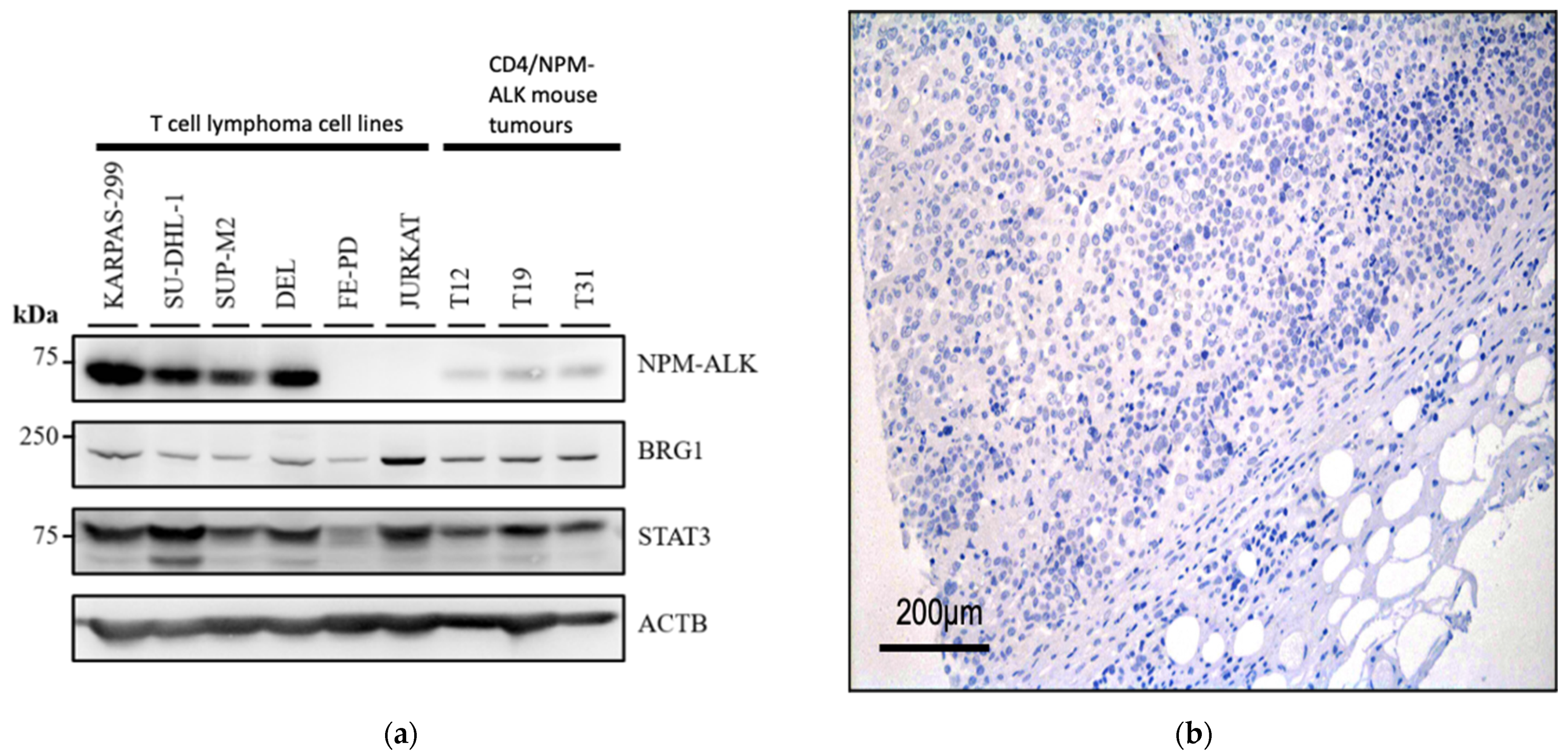 Cancers 14 00151 g001a Cancers 14 00151 g001a
