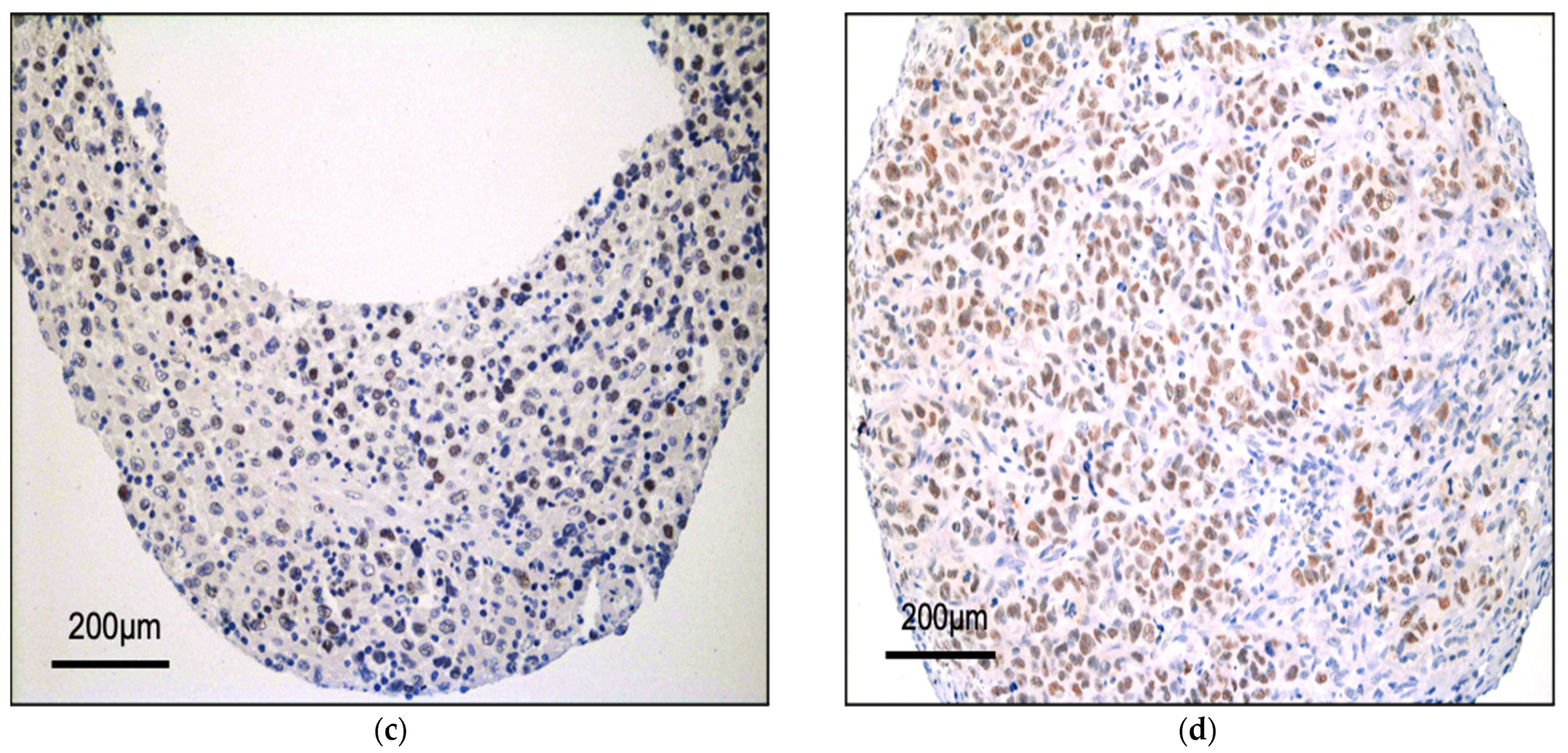 Cancers 14 00151 g001b Cancers 14 00151 g001b