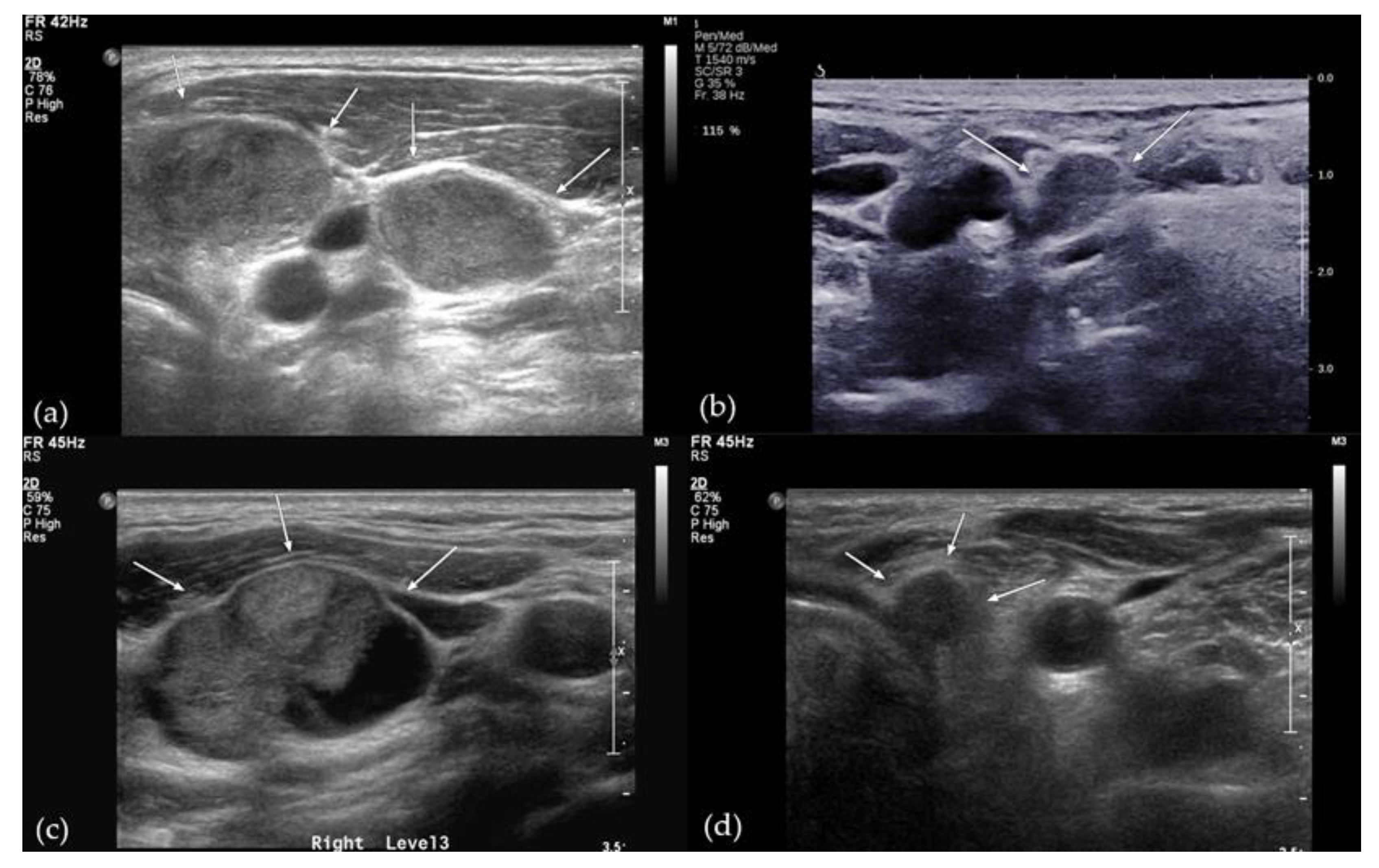 Cancers 14 00174 g003