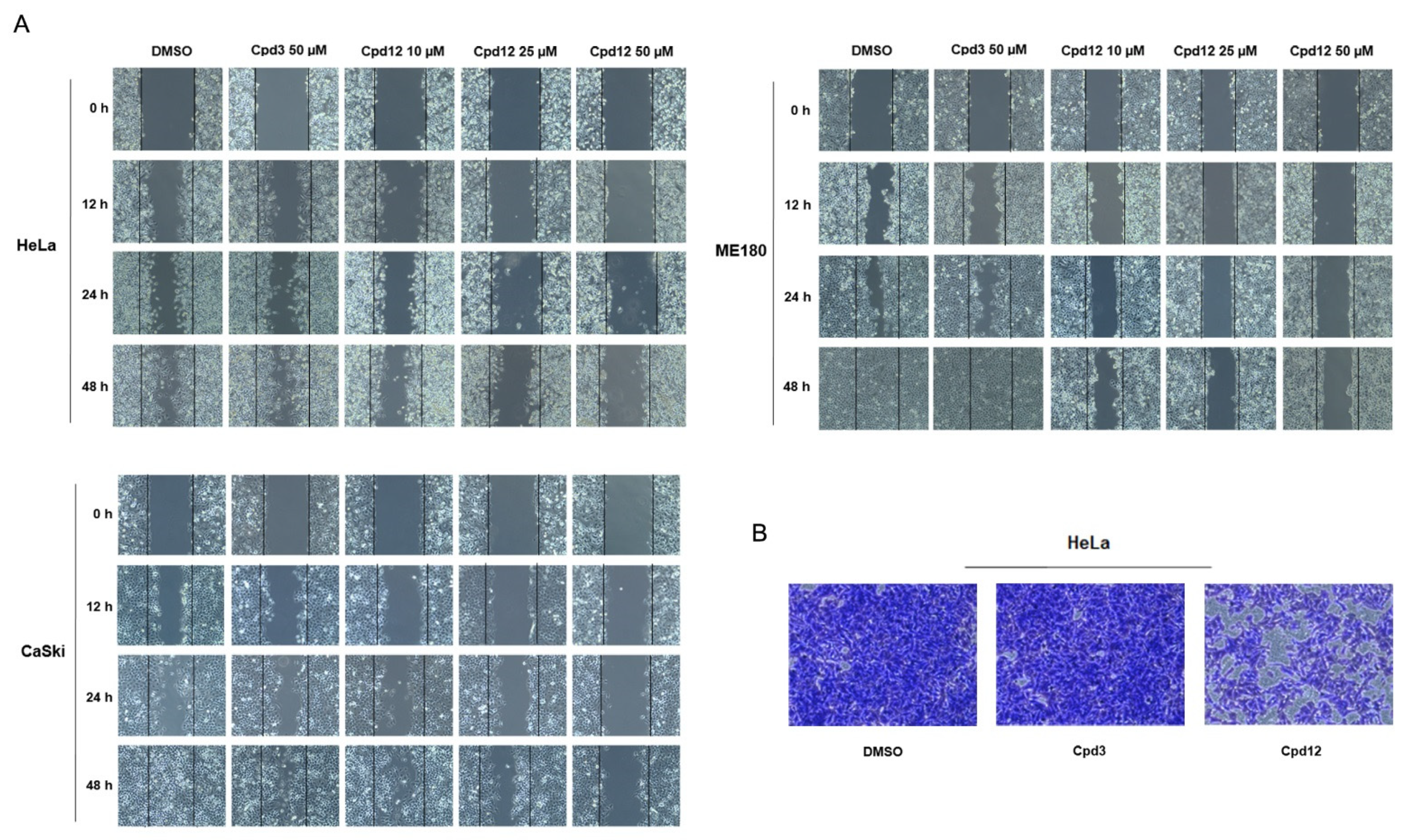 Cancers 14 00193 g004