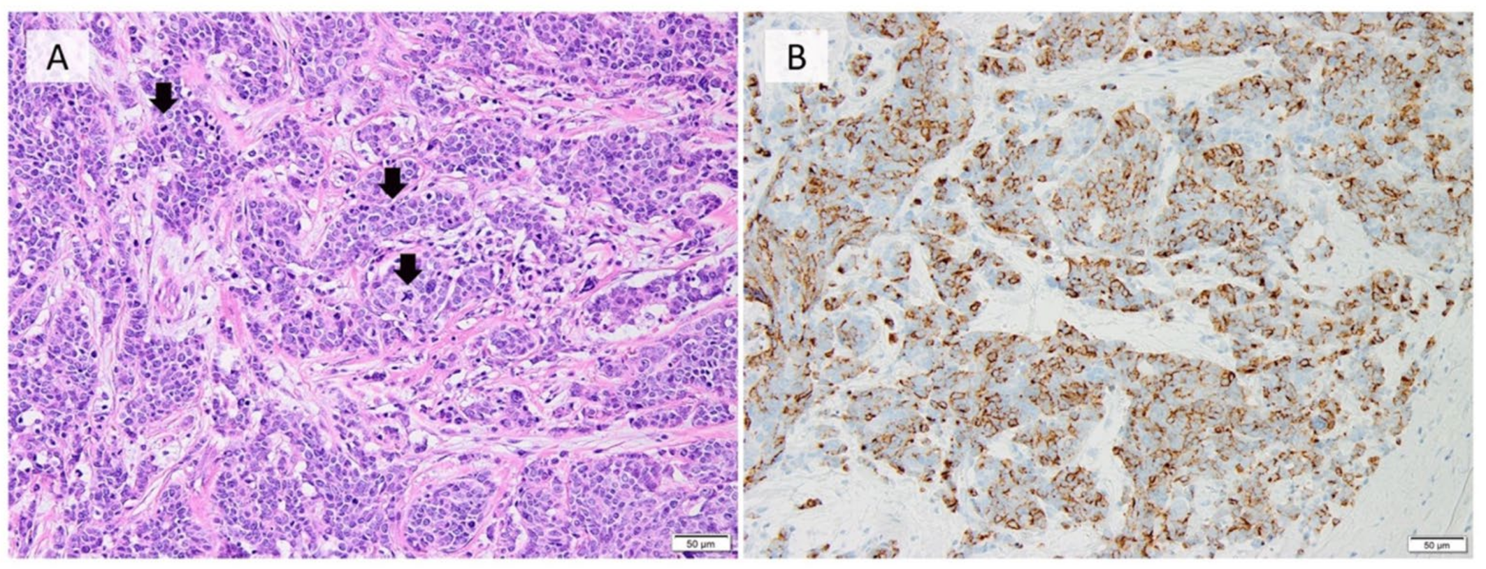 Cancers 14 00196 g003