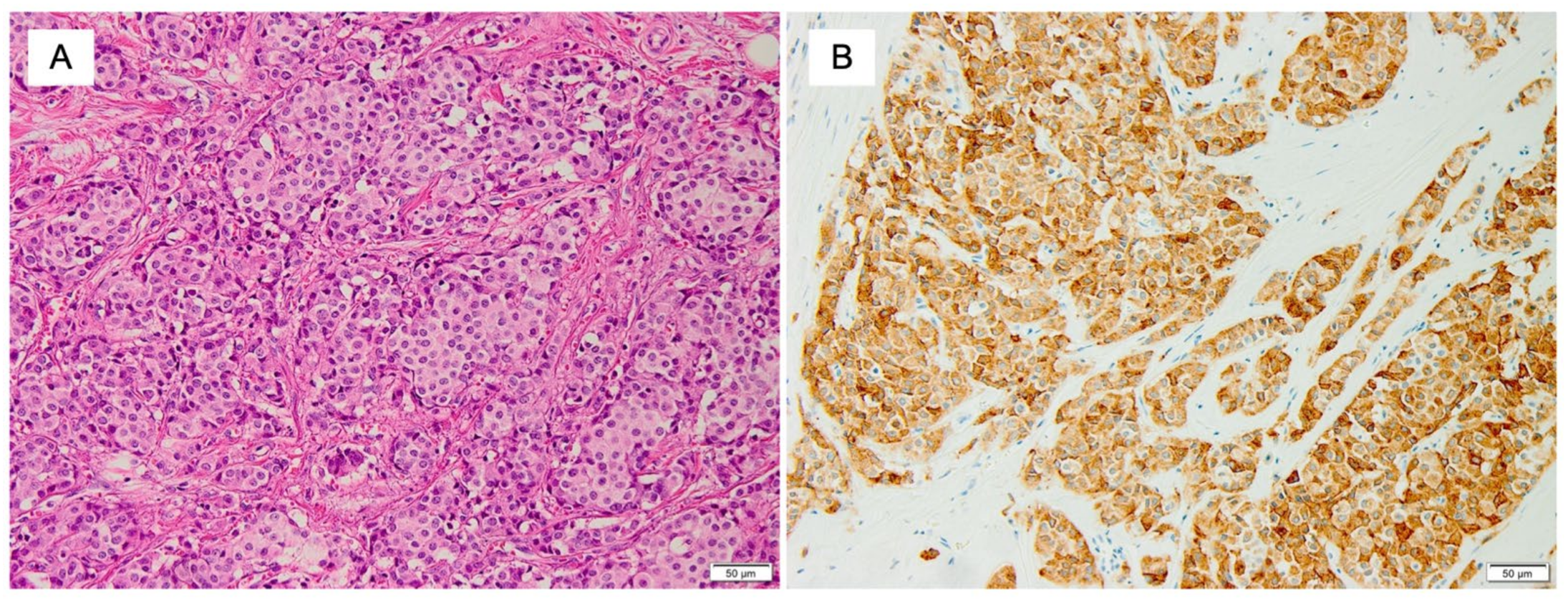 Cancers 14 00196 g004