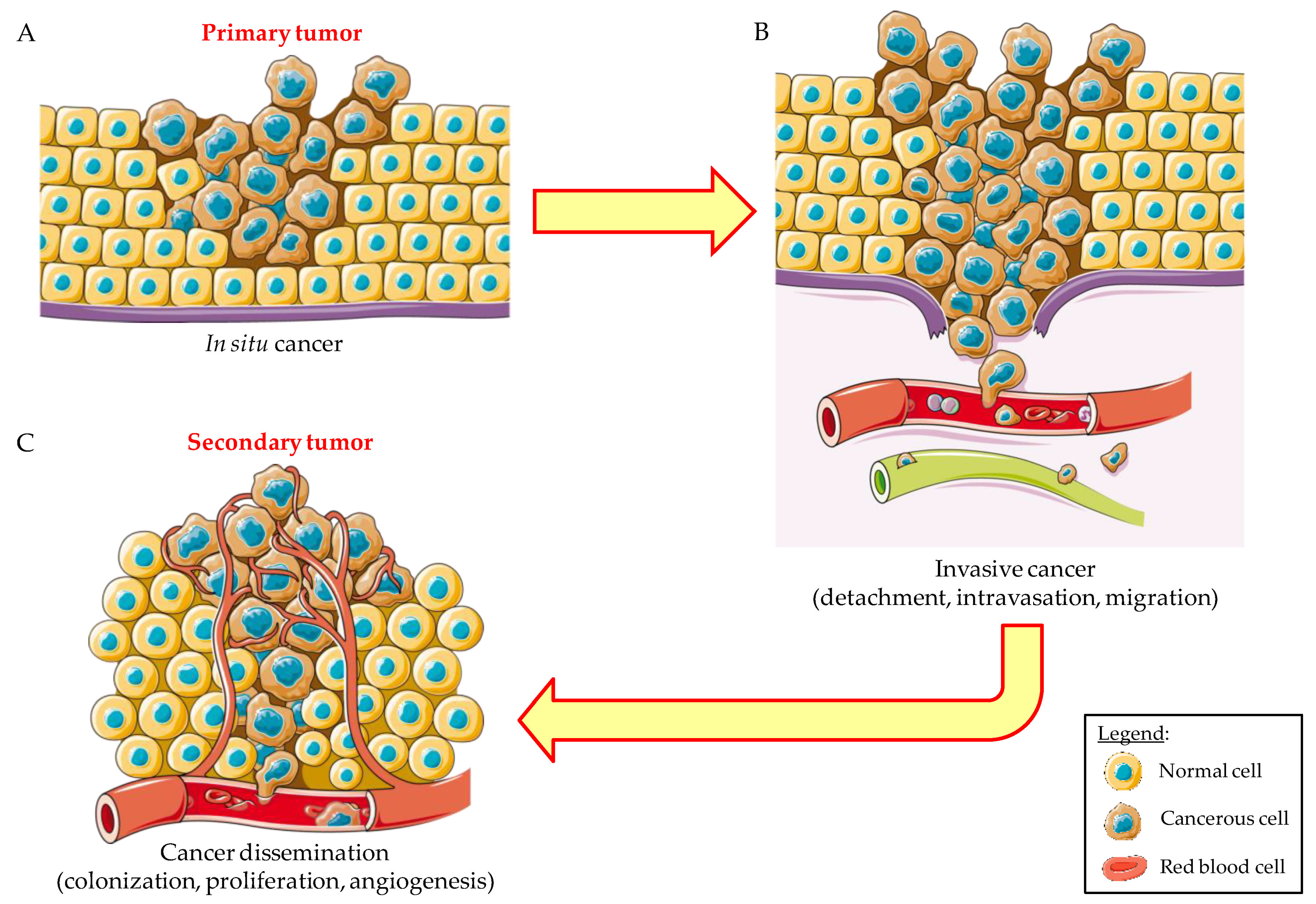 Cancers 14 00198 g006 Cancers 14 00198 g006