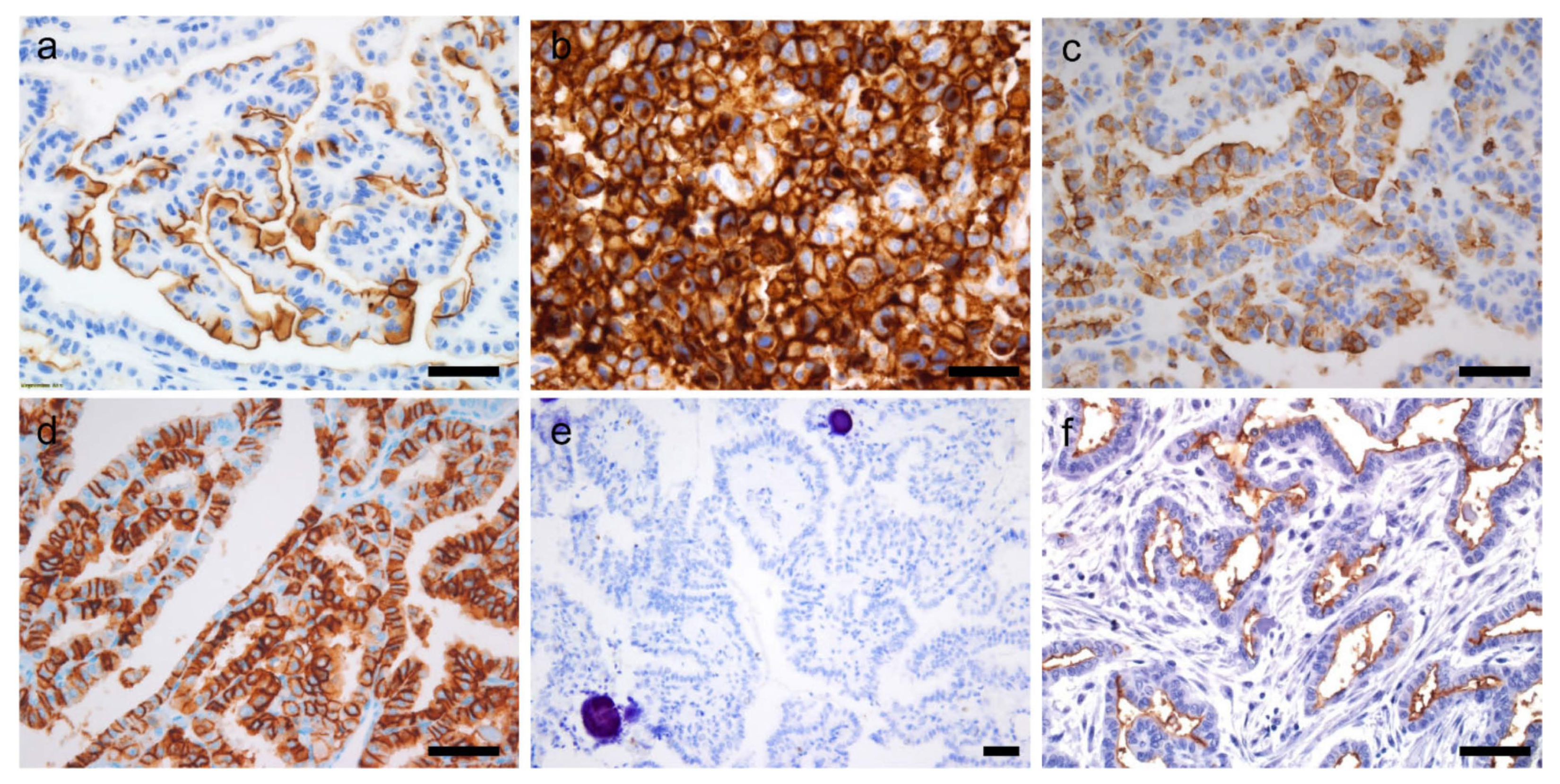 Cancers 14 00204 g007