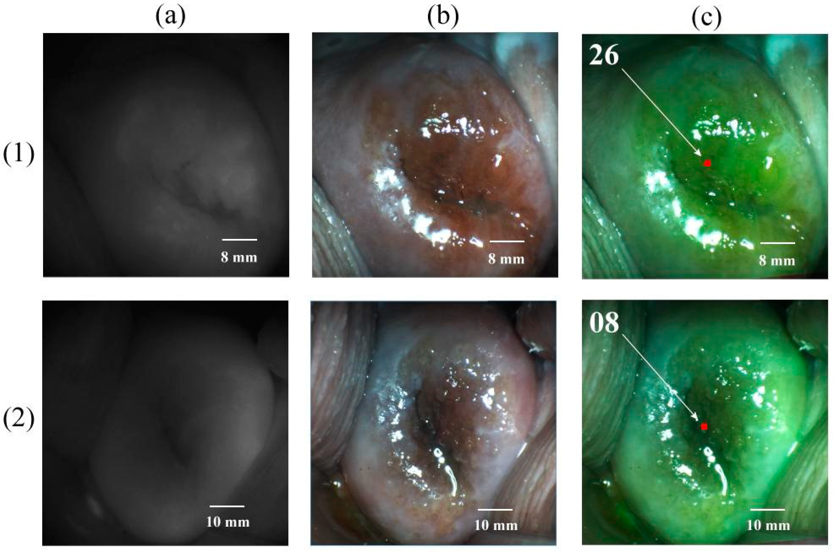 Cancers 14 00211 g004 550