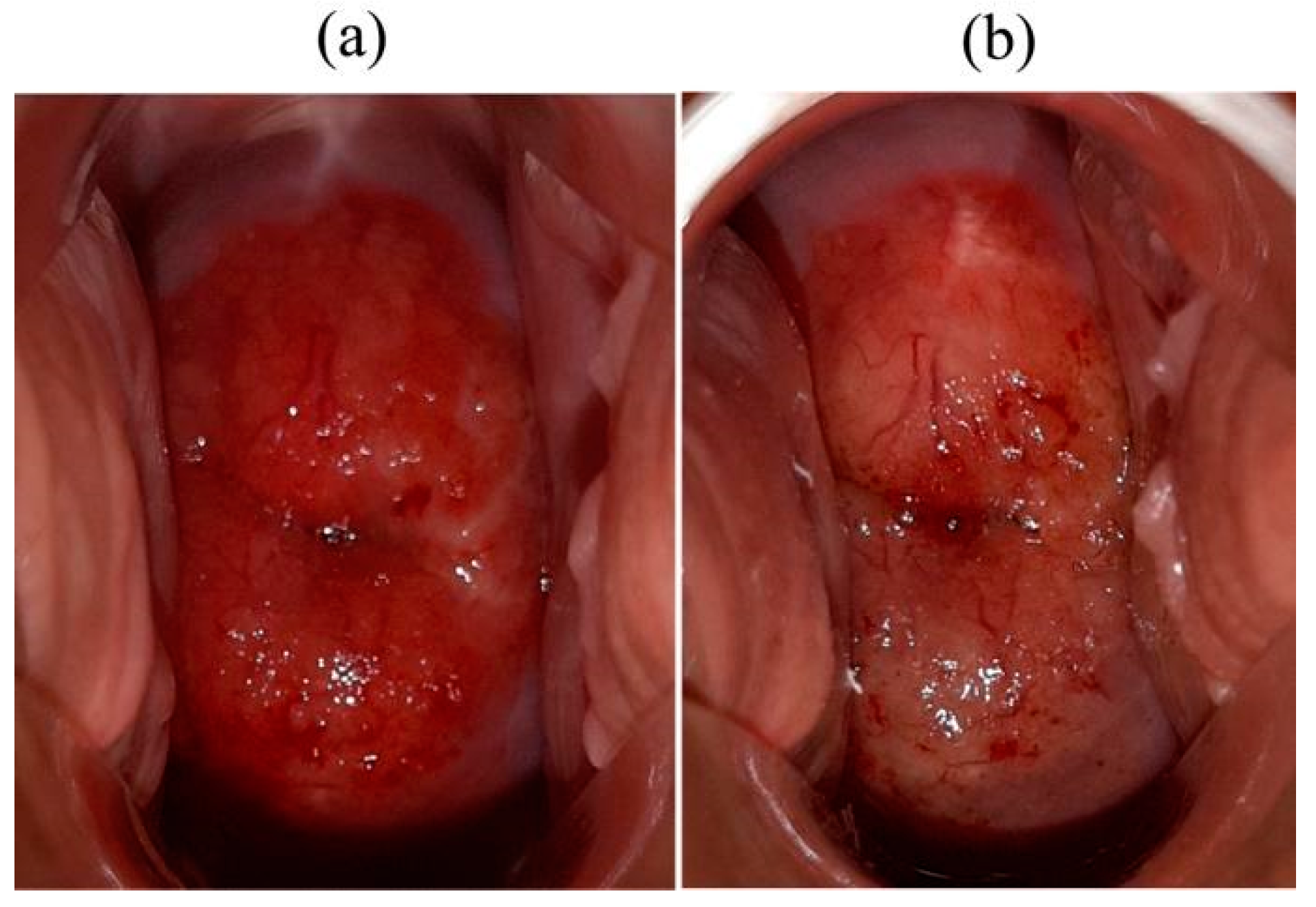 Cancers 14 00211 g007 550
