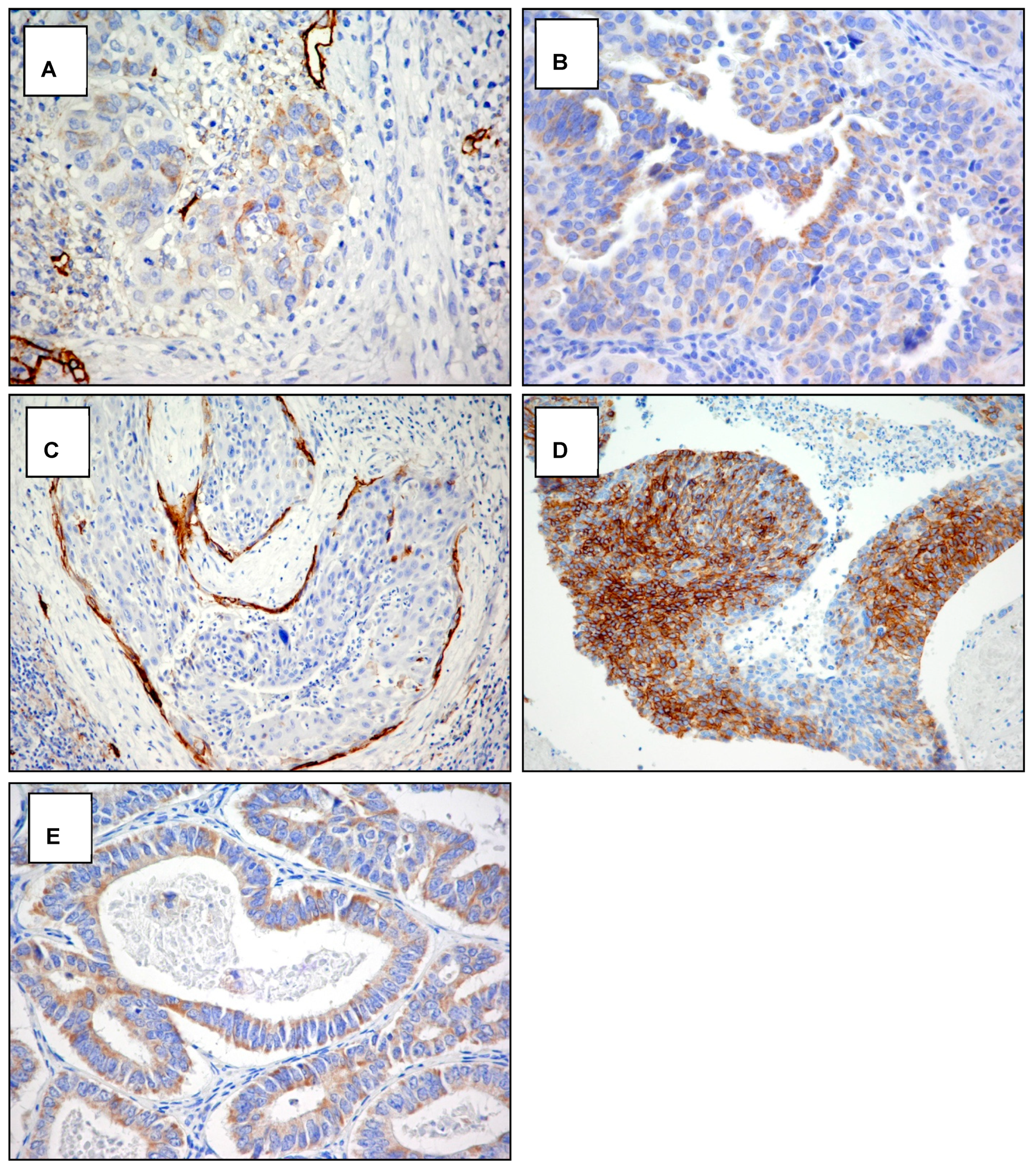 Cancers 14 00212 g0a3