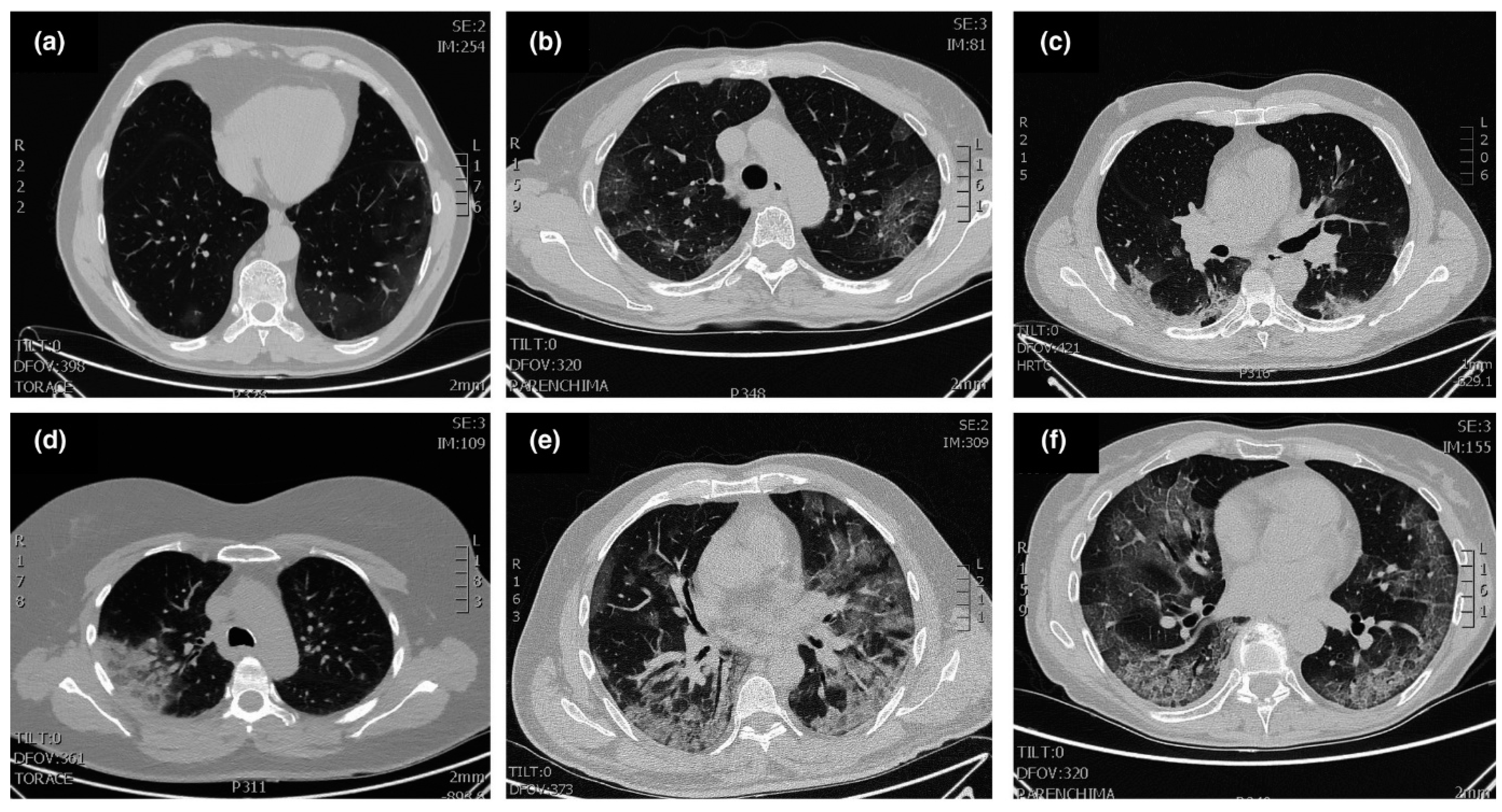 Cancers 14 00213 g003