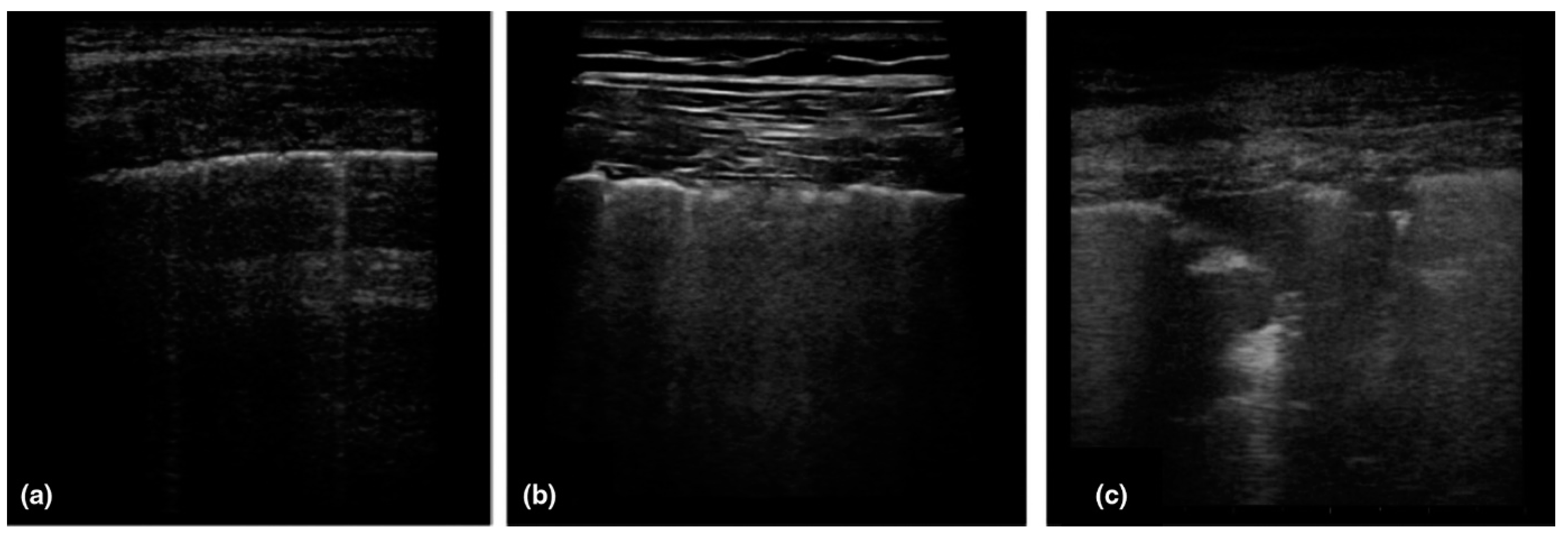 Cancers 14 00213 g004