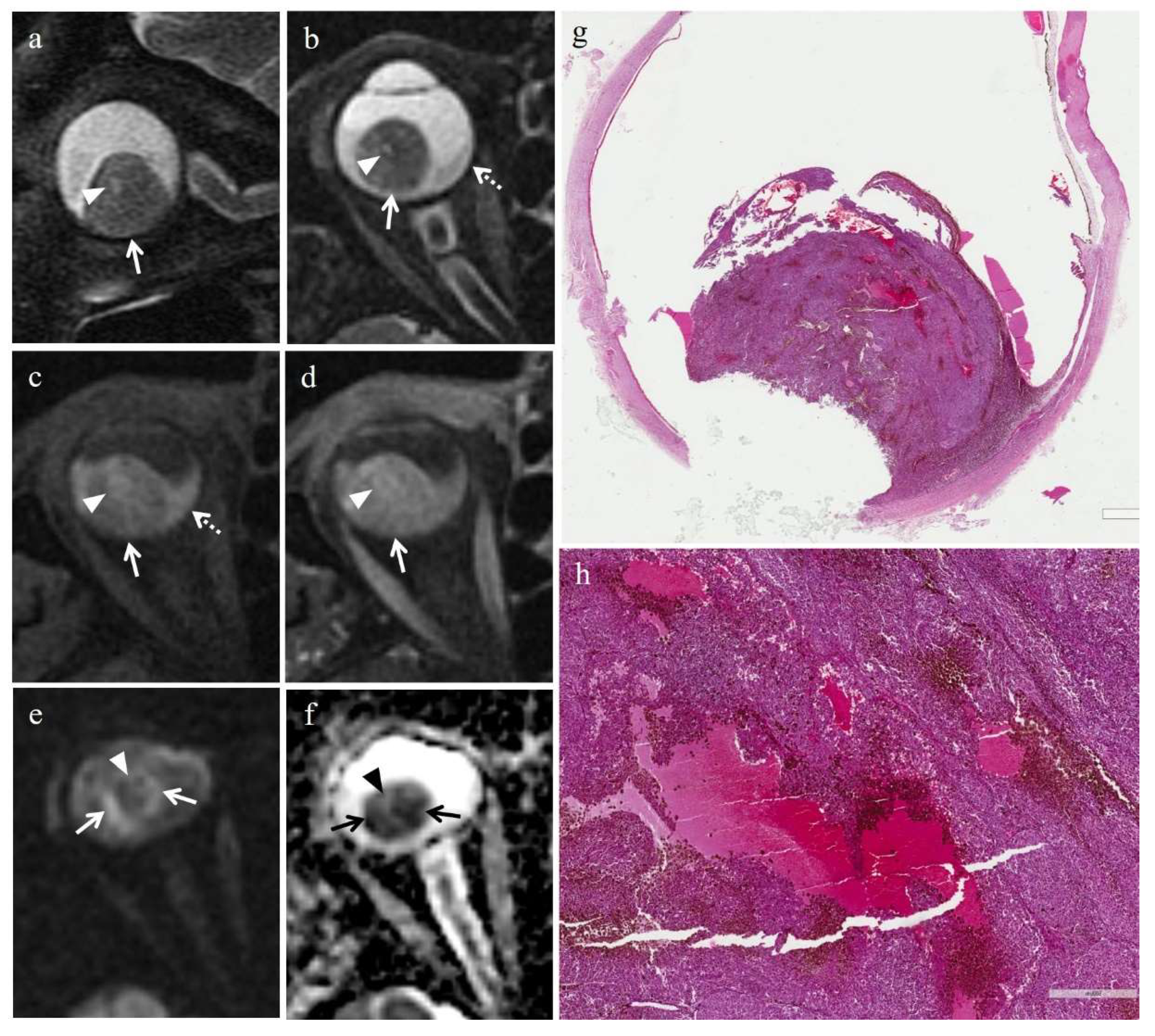 Cancers 14 00215 g005 550