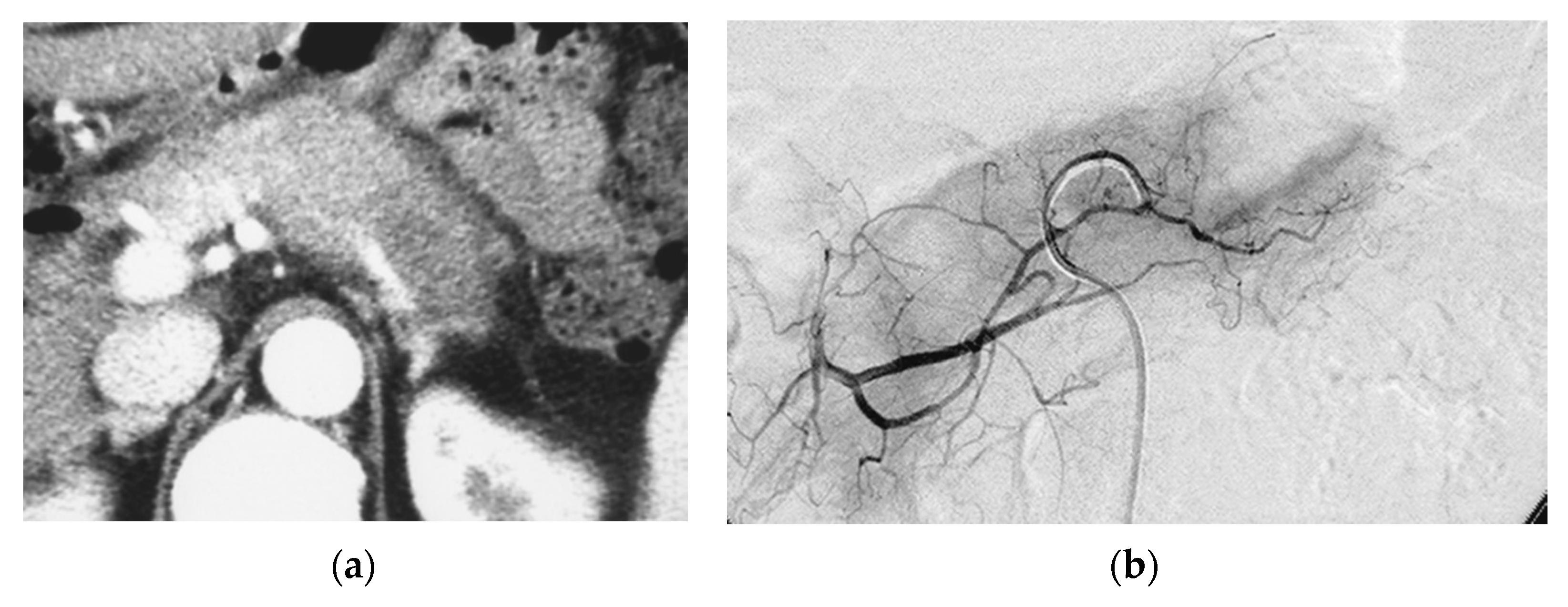 Cancers 14 00220 g001a Cancers 14 00220 g001a