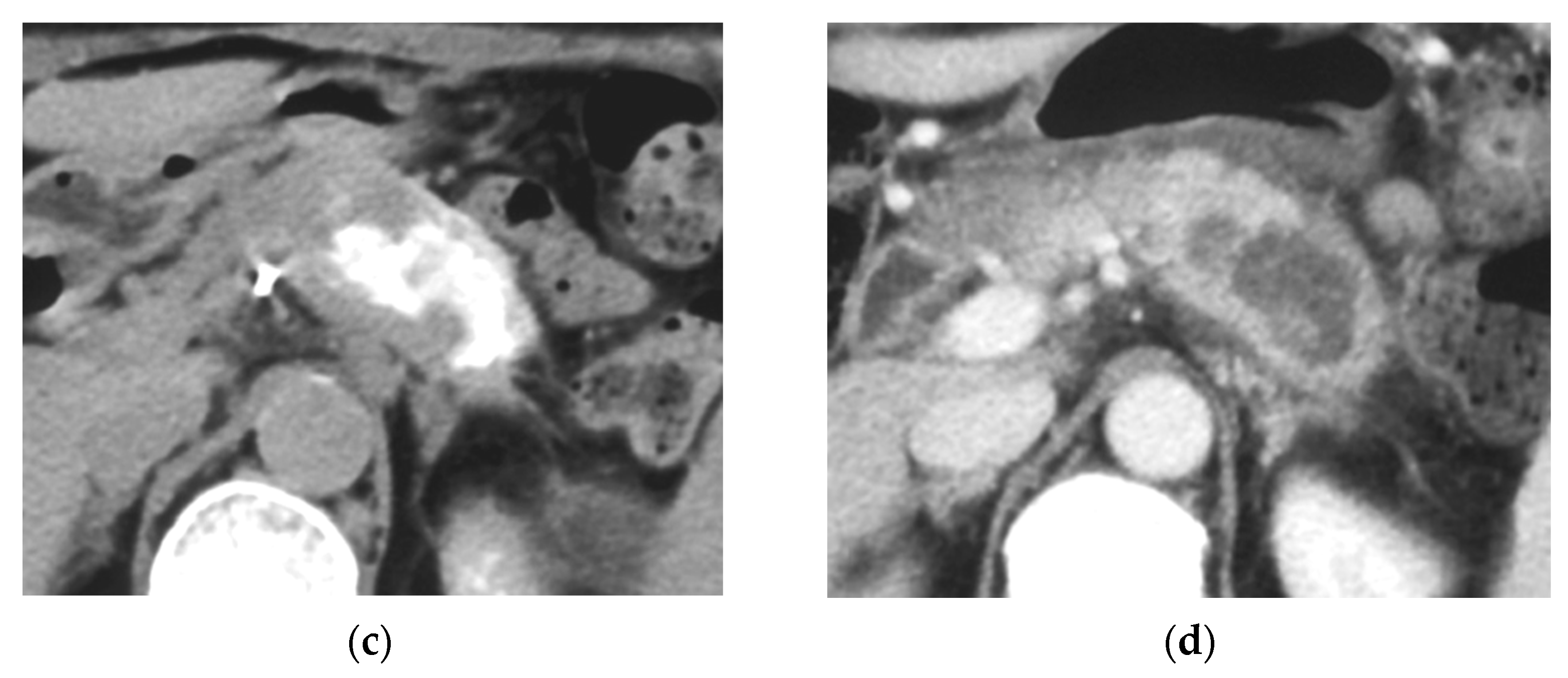 Cancers 14 00220 g001b Cancers 14 00220 g001b