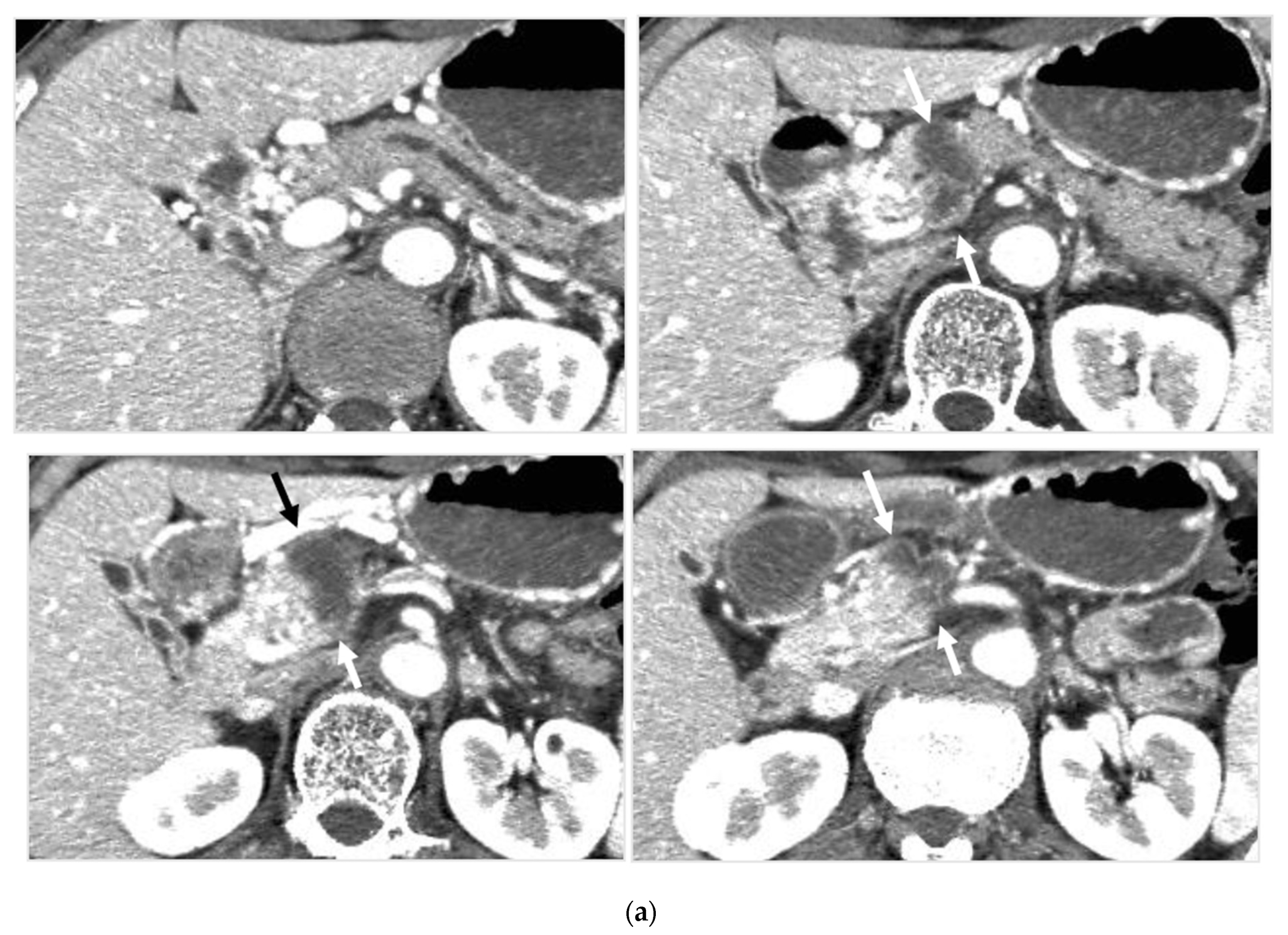 Cancers 14 00220 g004a Cancers 14 00220 g004a