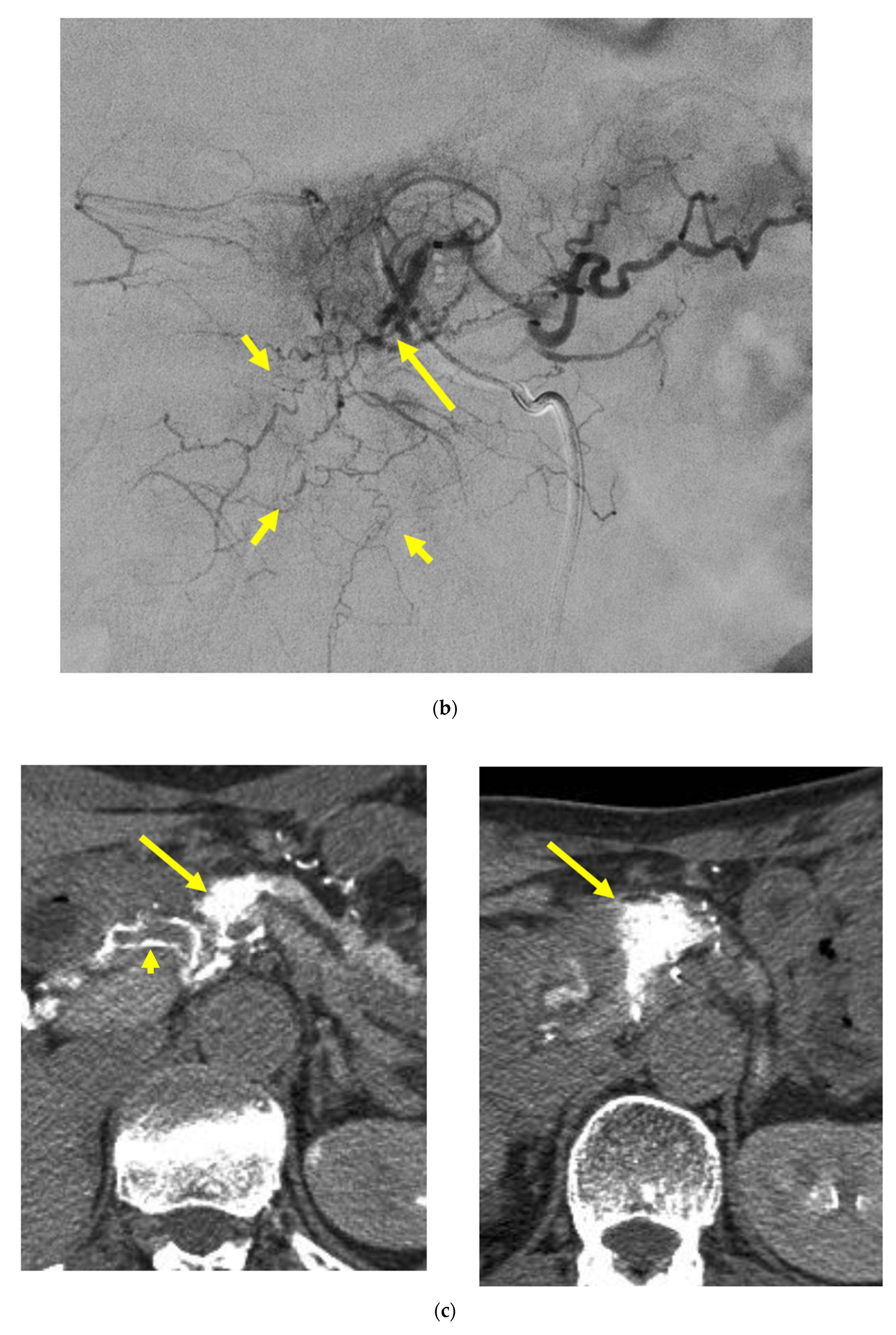 Cancers 14 00220 g004b Cancers 14 00220 g004b