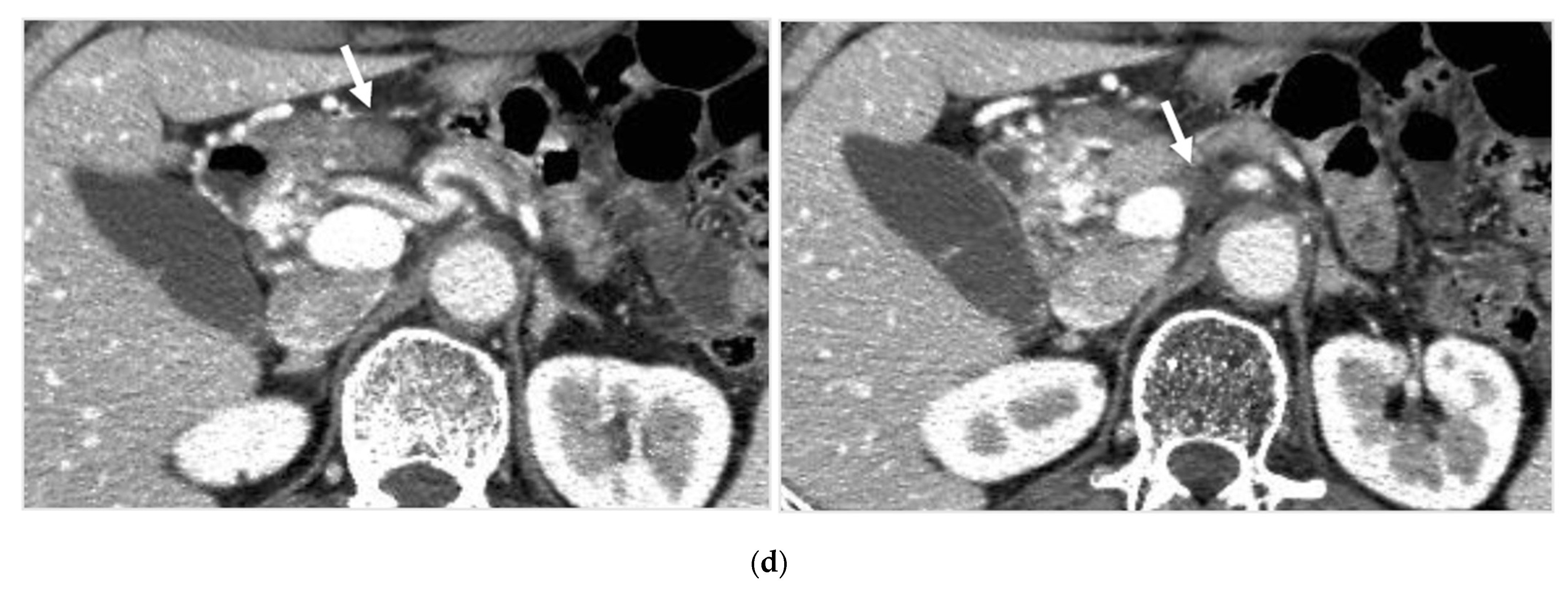 Cancers 14 00220 g004c Cancers 14 00220 g004c