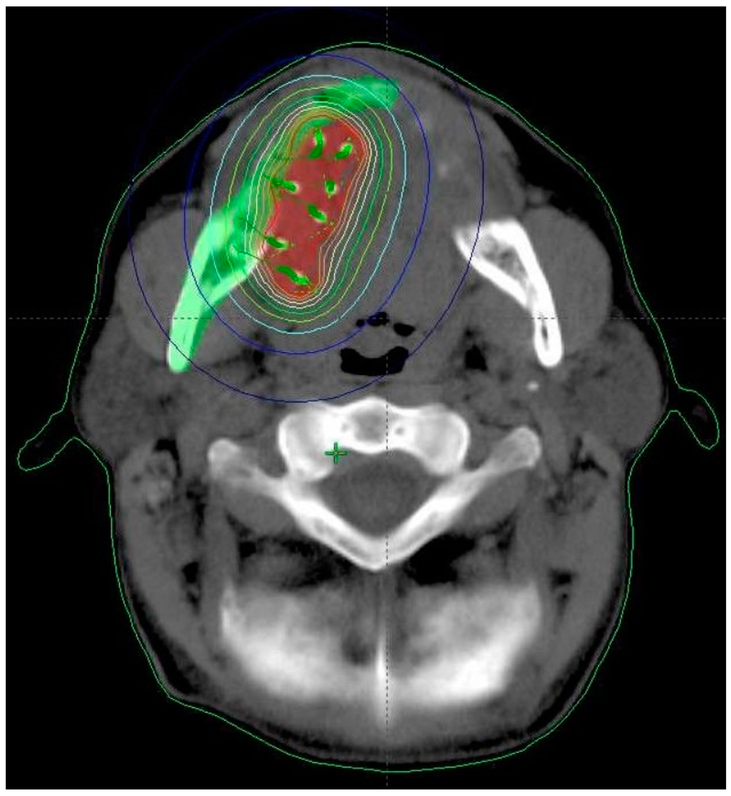 Cancers 14 00222 g001 Cancers 14 00222 g001