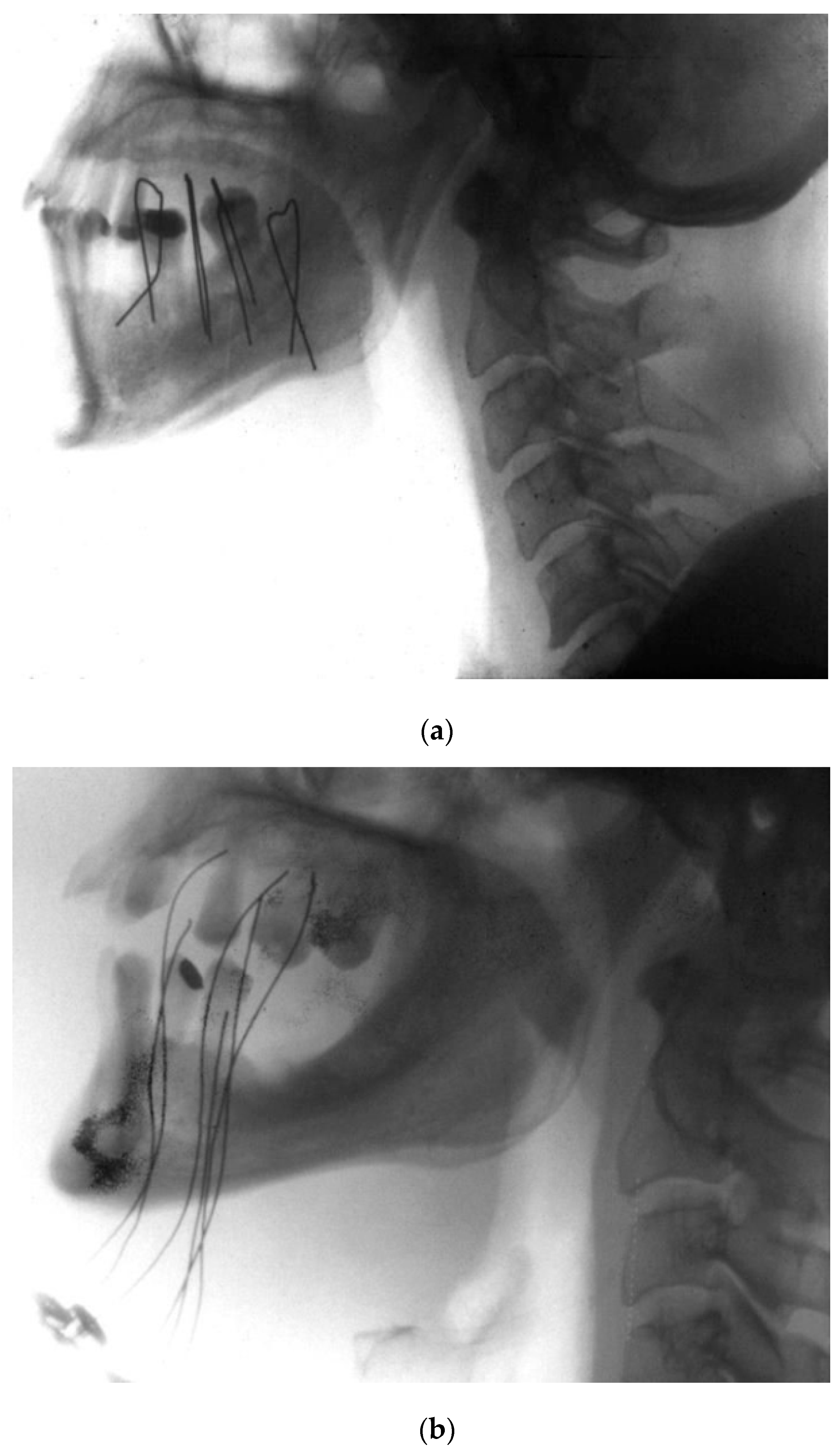 Cancers 14 00222 g003 Cancers 14 00222 g003