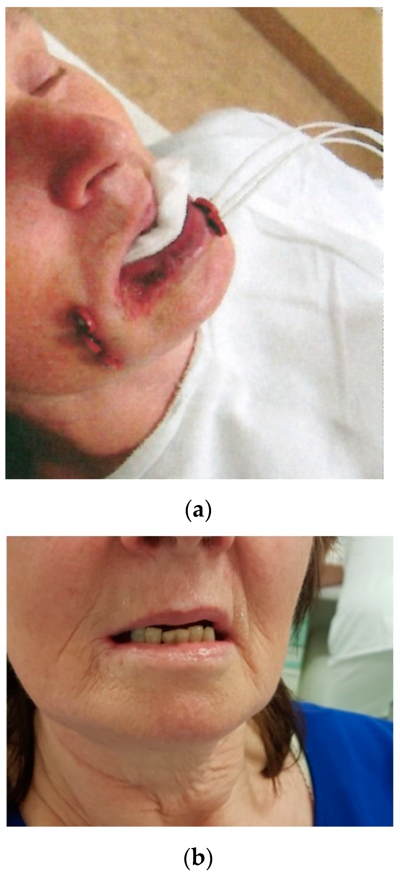 Cancers 14 00222 g004 Cancers 14 00222 g004