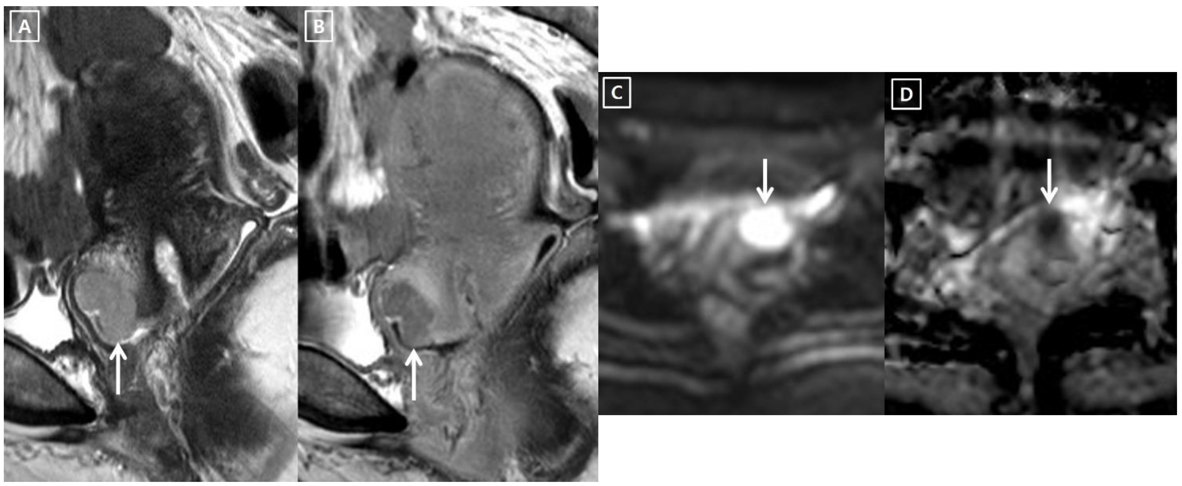 Cancers 14 00224 g003