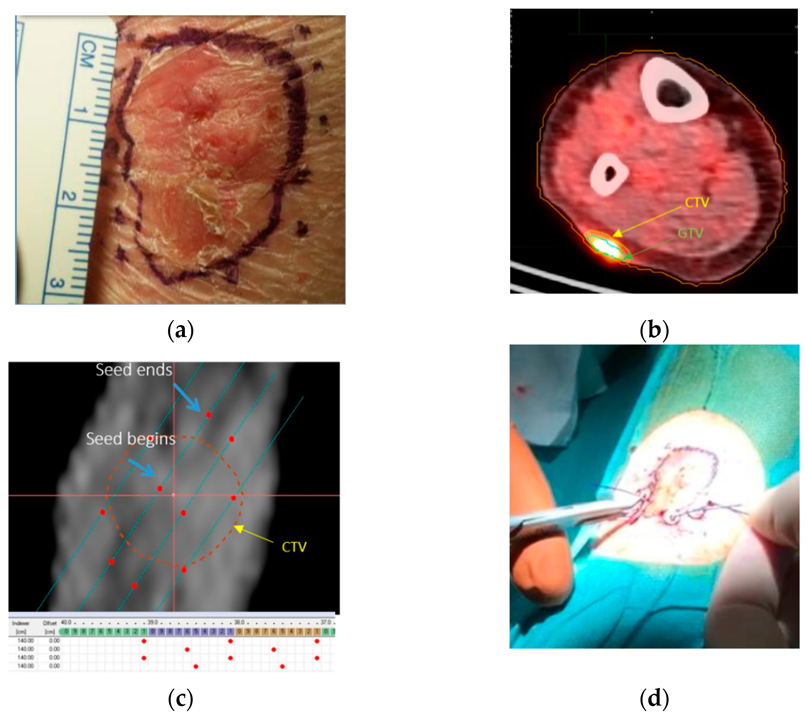 Cancers 14 00240 g002