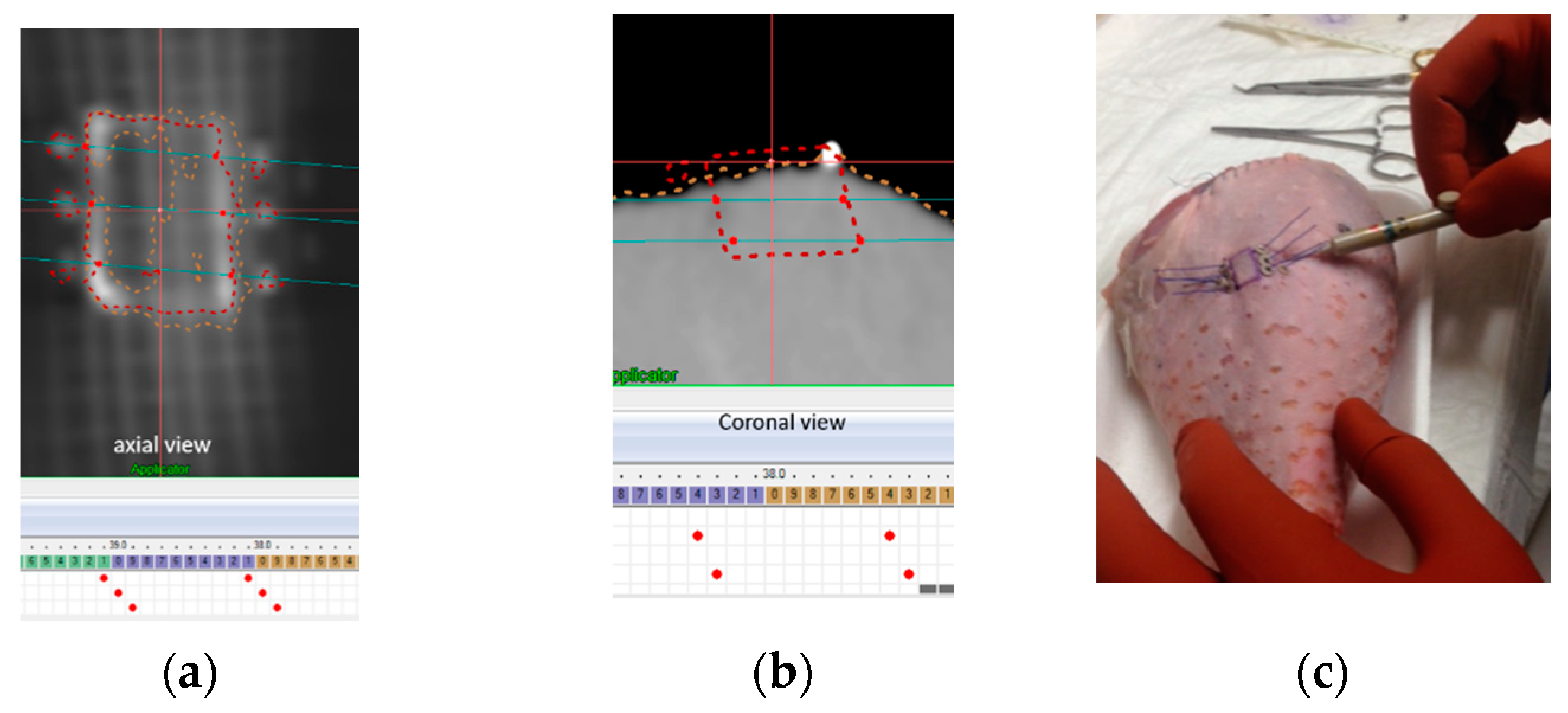 Cancers 14 00240 g005
