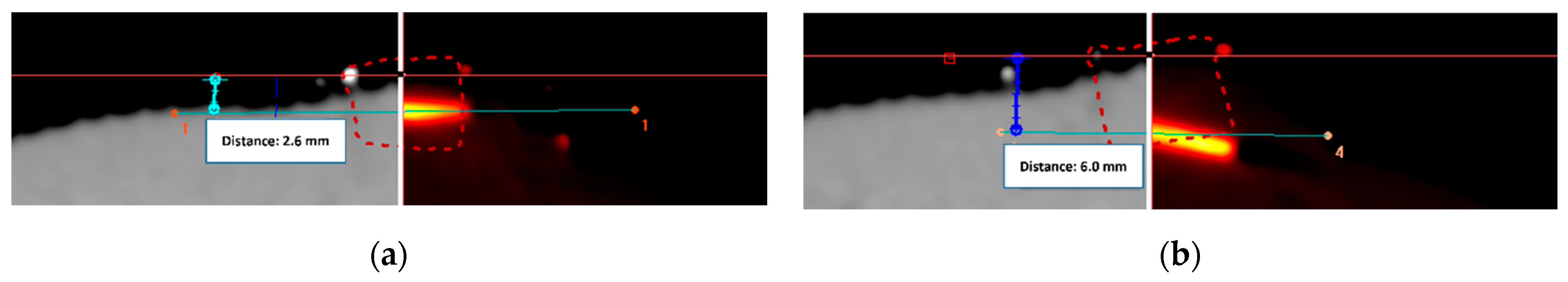 Cancers 14 00240 g006