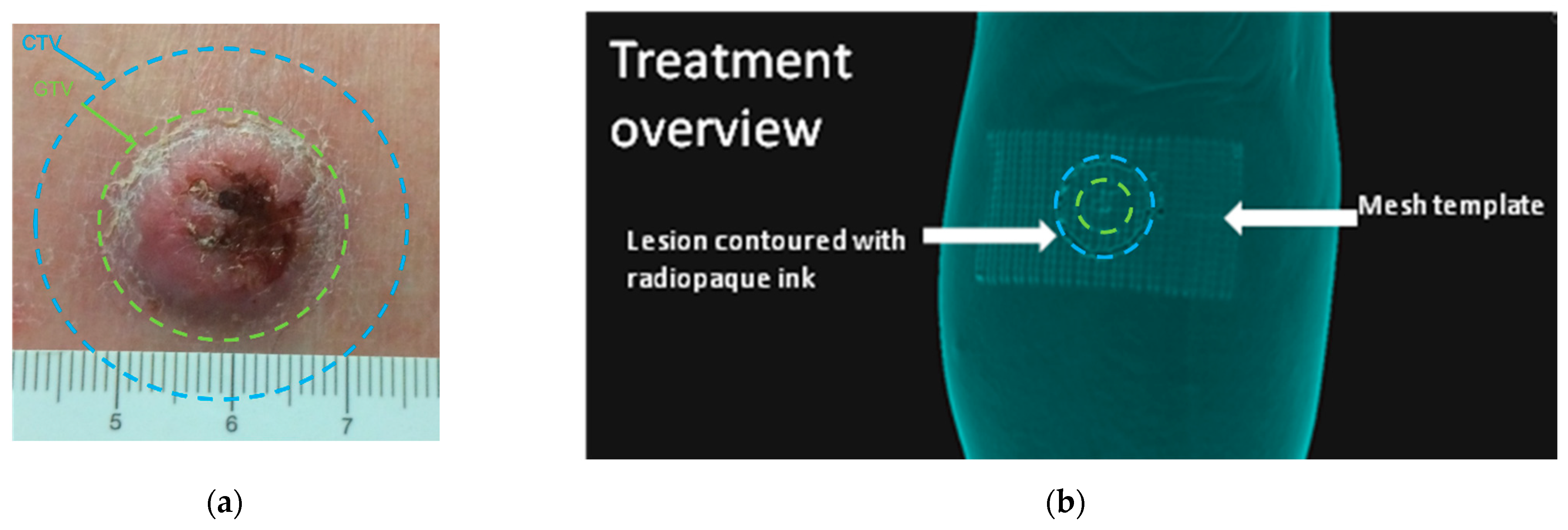 Cancers 14 00240 g007