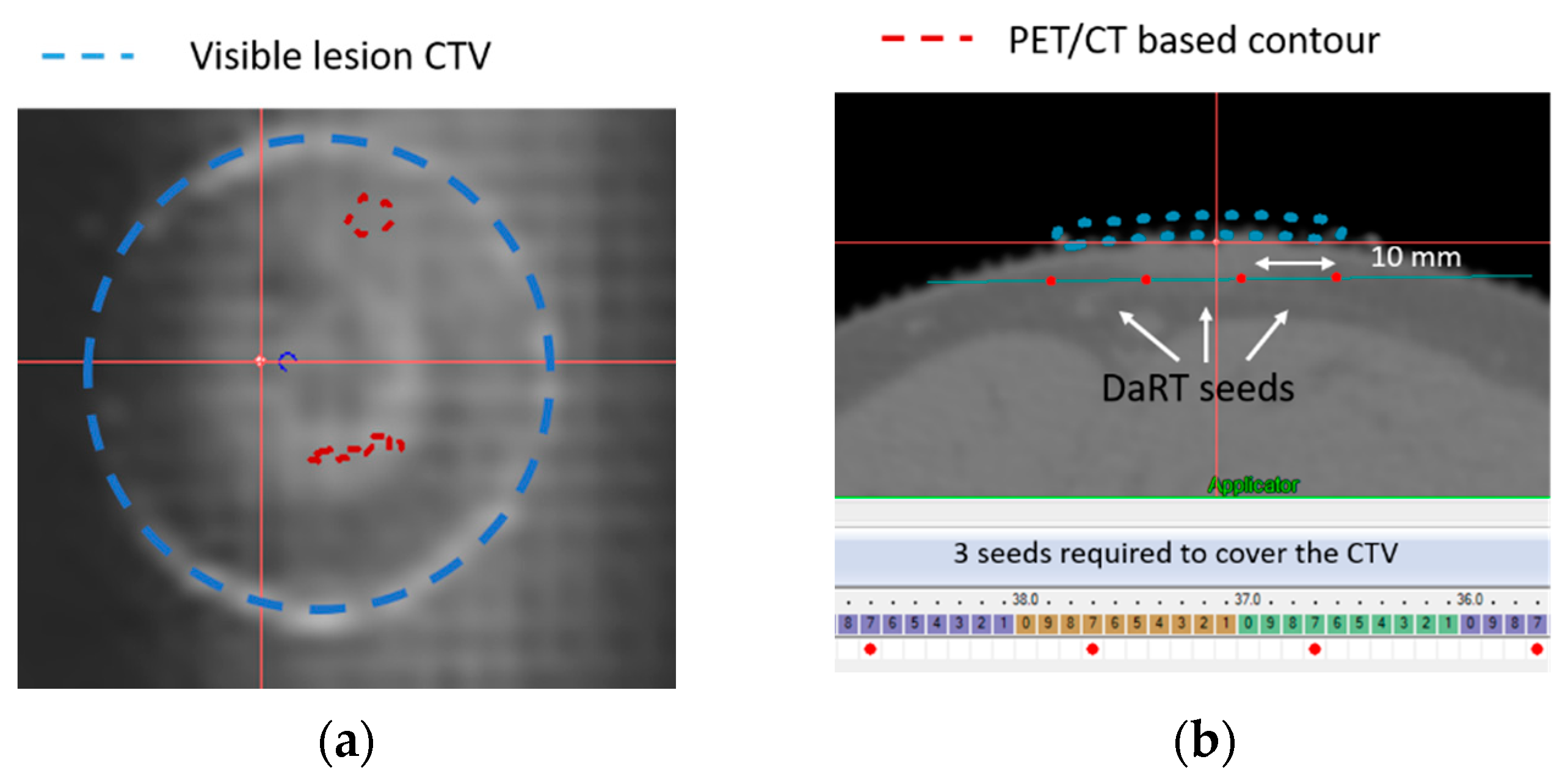 Cancers 14 00240 g008a