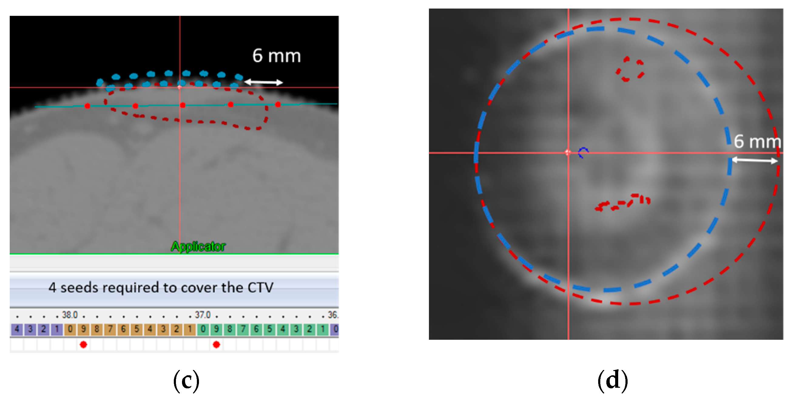 Cancers 14 00240 g008b