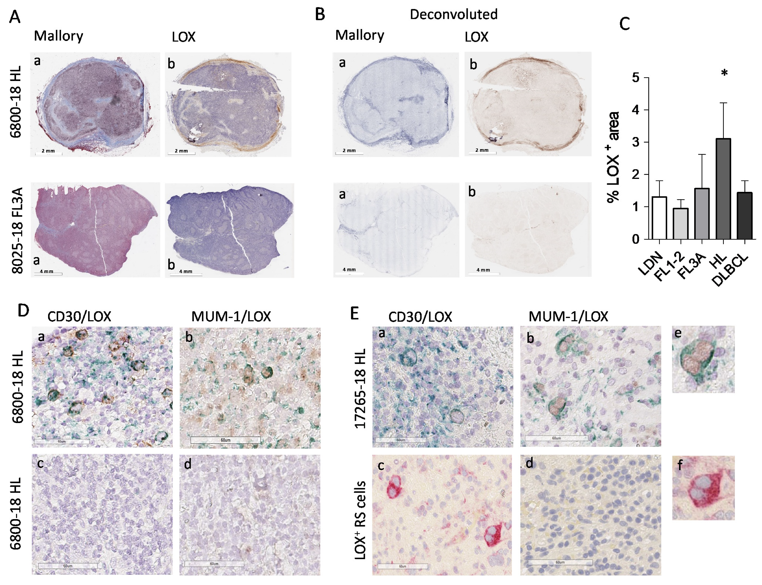 Cancers 14 00259 g004