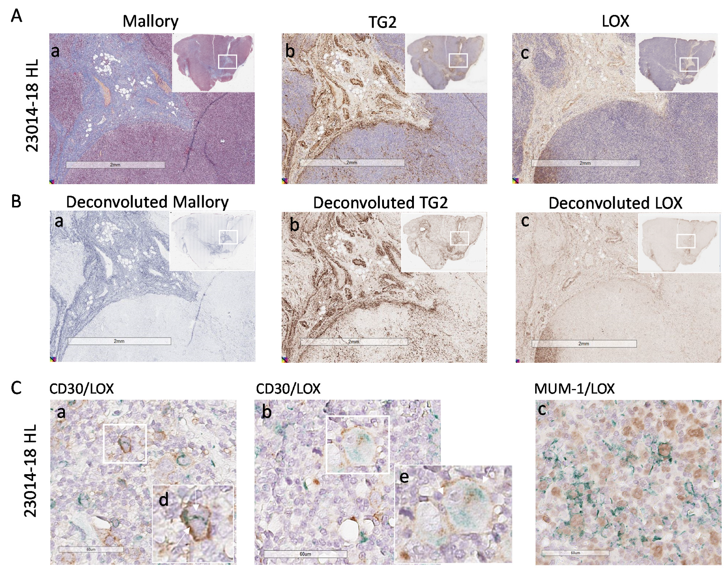 Cancers 14 00259 g005