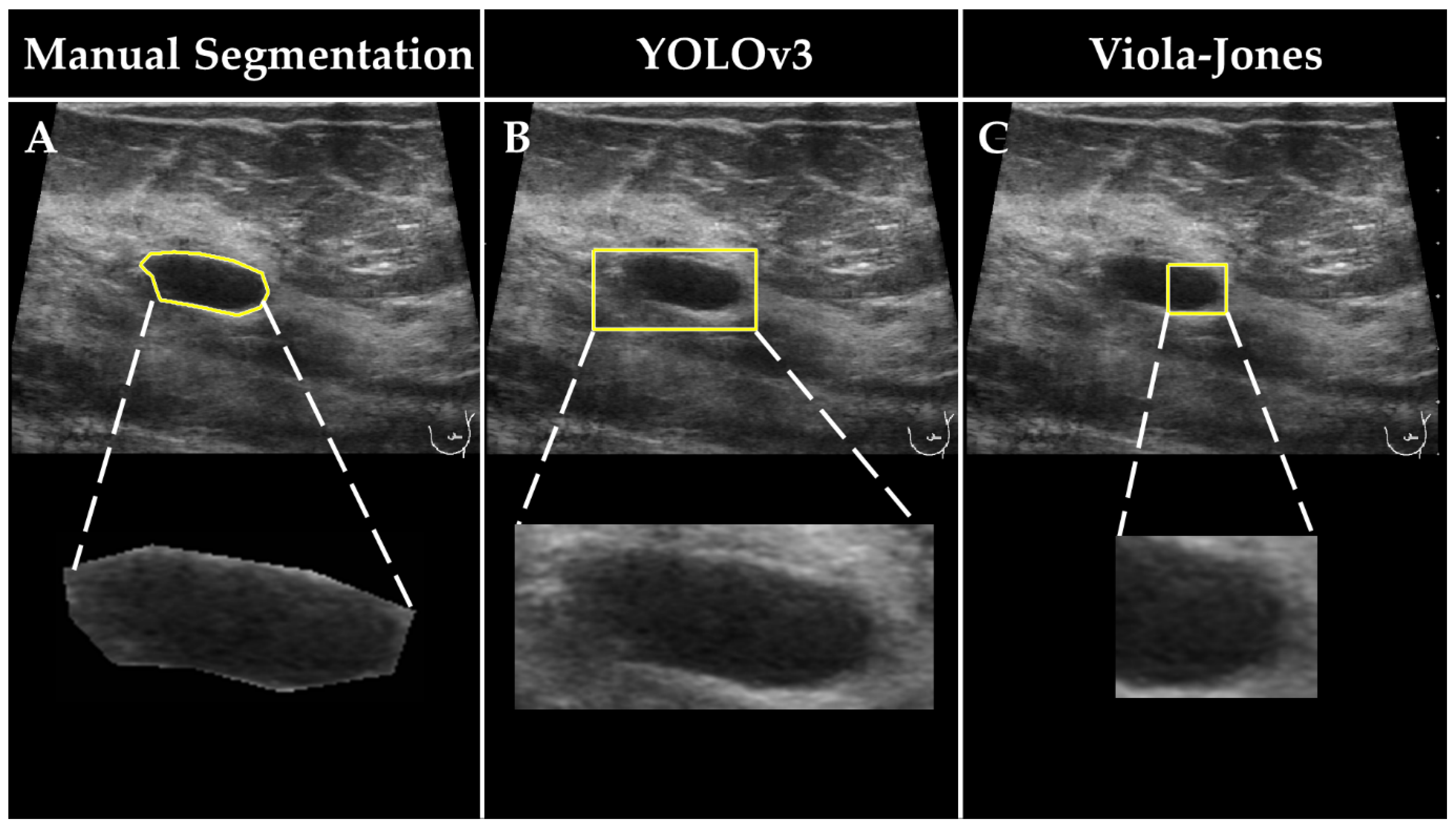Cancers 14 00277 g002 550