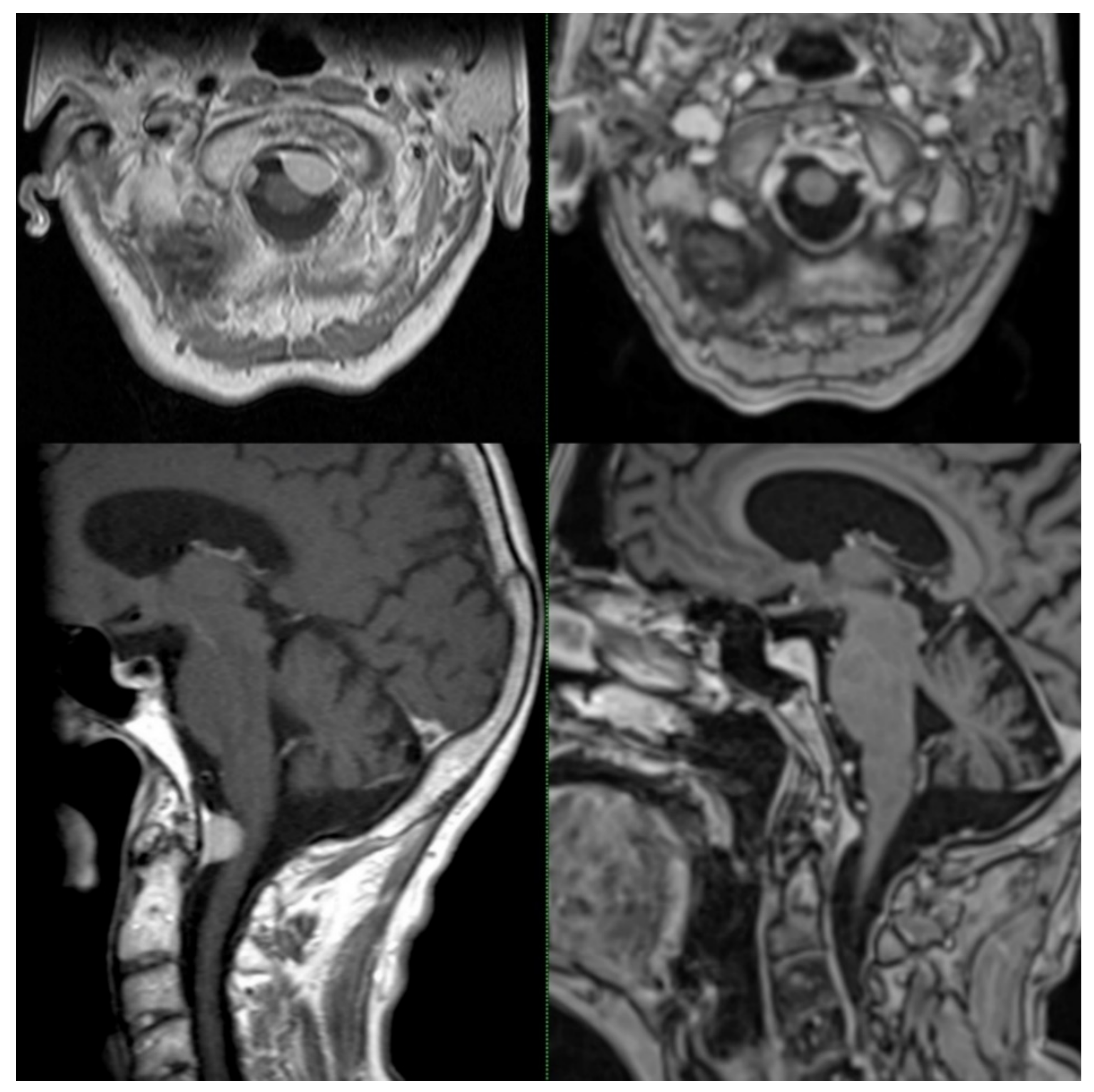 Cancers 14 00341 g003 Cancers 14 00341 g003