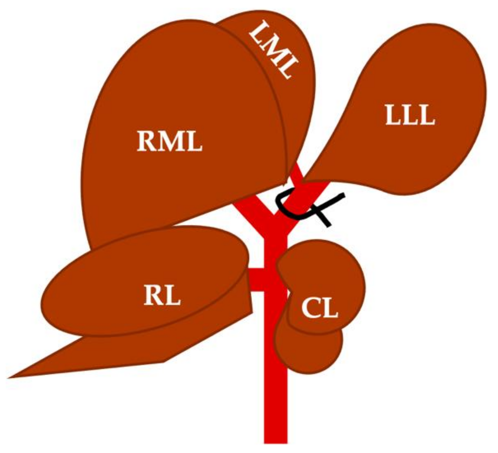 Cancers | Free Full-Text | Folinic Acid Potentiates the Liver Regeneration  Process after Selective Portal Vein Ligation in Rats