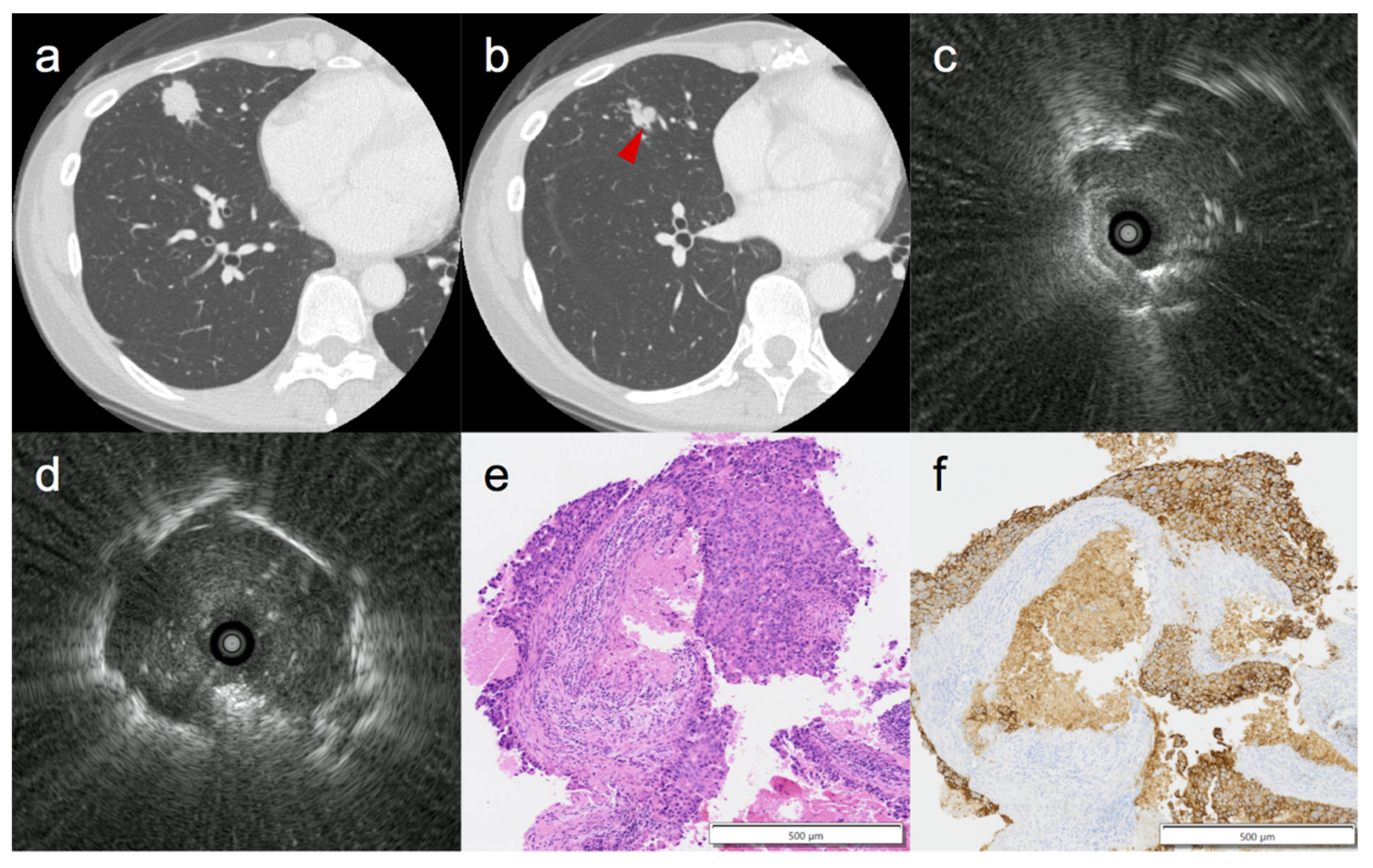 Cancers 14 00375 g001