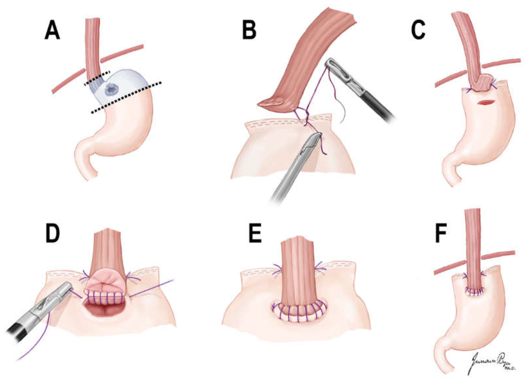 Cancers 14 00379 g001